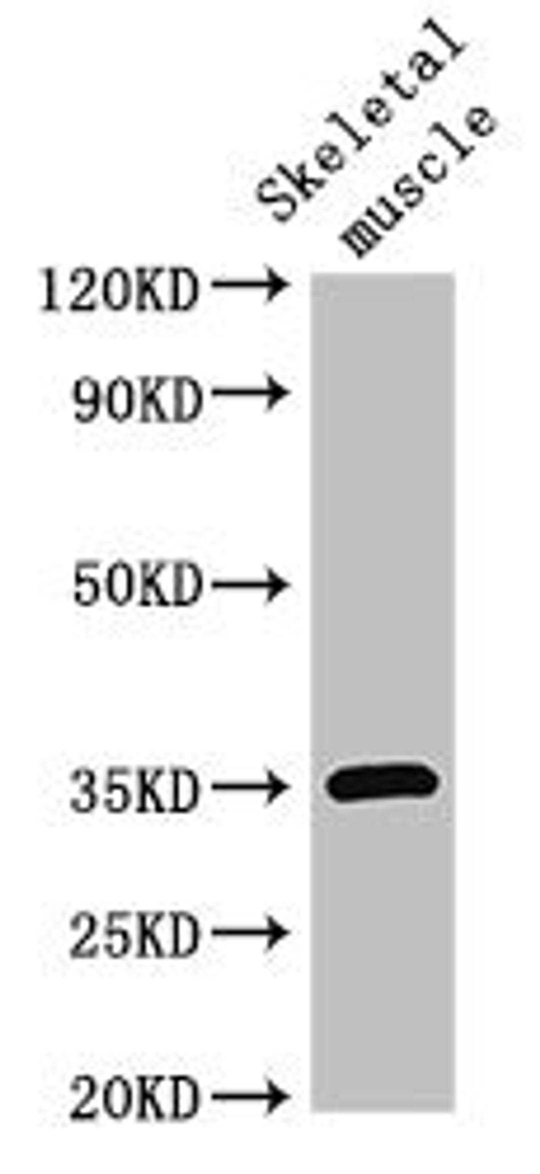 Western Blot. Positive WB detected in: Mouse skeletal muscle tissue. All lanes: ELMOD2 antibody at 3ug/ml. Secondary. Goat polyclonal to rabbit IgG at 1/50000 dilution. Predicted band size: 35 kDa. Observed band size: 35 kDa. 