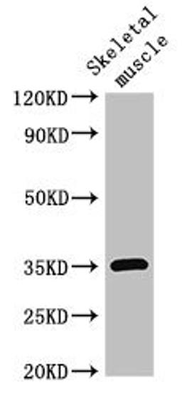 Western Blot. Positive WB detected in: Mouse skeletal muscle tissue. All lanes: ELMOD2 antibody at 3ug/ml. Secondary. Goat polyclonal to rabbit IgG at 1/50000 dilution. Predicted band size: 35 kDa. Observed band size: 35 kDa. 