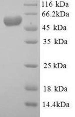 (Tris-Glycine gel) Discontinuous SDS-PAGE (reduced) with 5% enrichment gel and 15% separation gel.