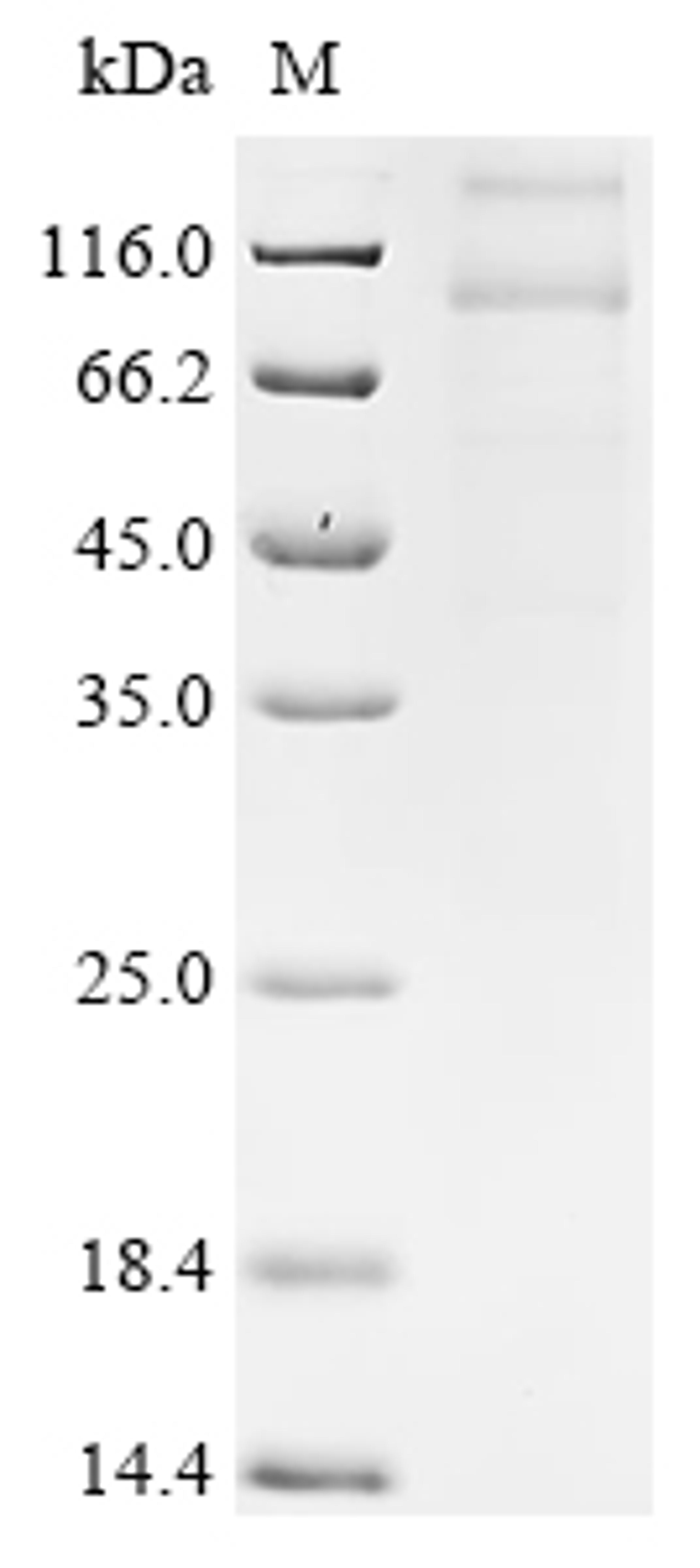 (Tris-Glycine gel) Discontinuous SDS-PAGE (reduced) with 5% enrichment gel and 15% separation gel.