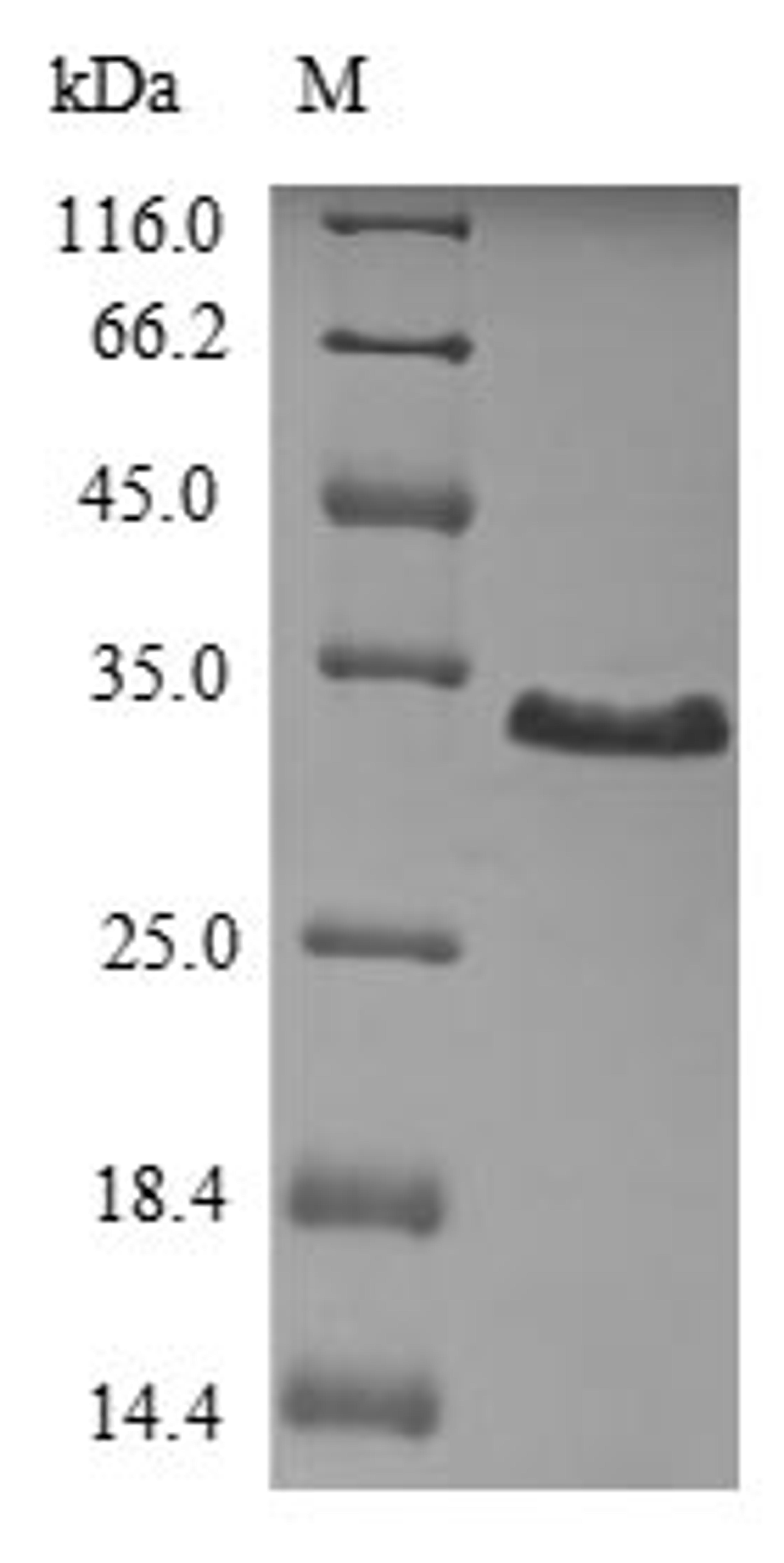 (Tris-Glycine gel) Discontinuous SDS-PAGE (reduced) with 5% enrichment gel and 15% separation gel.
