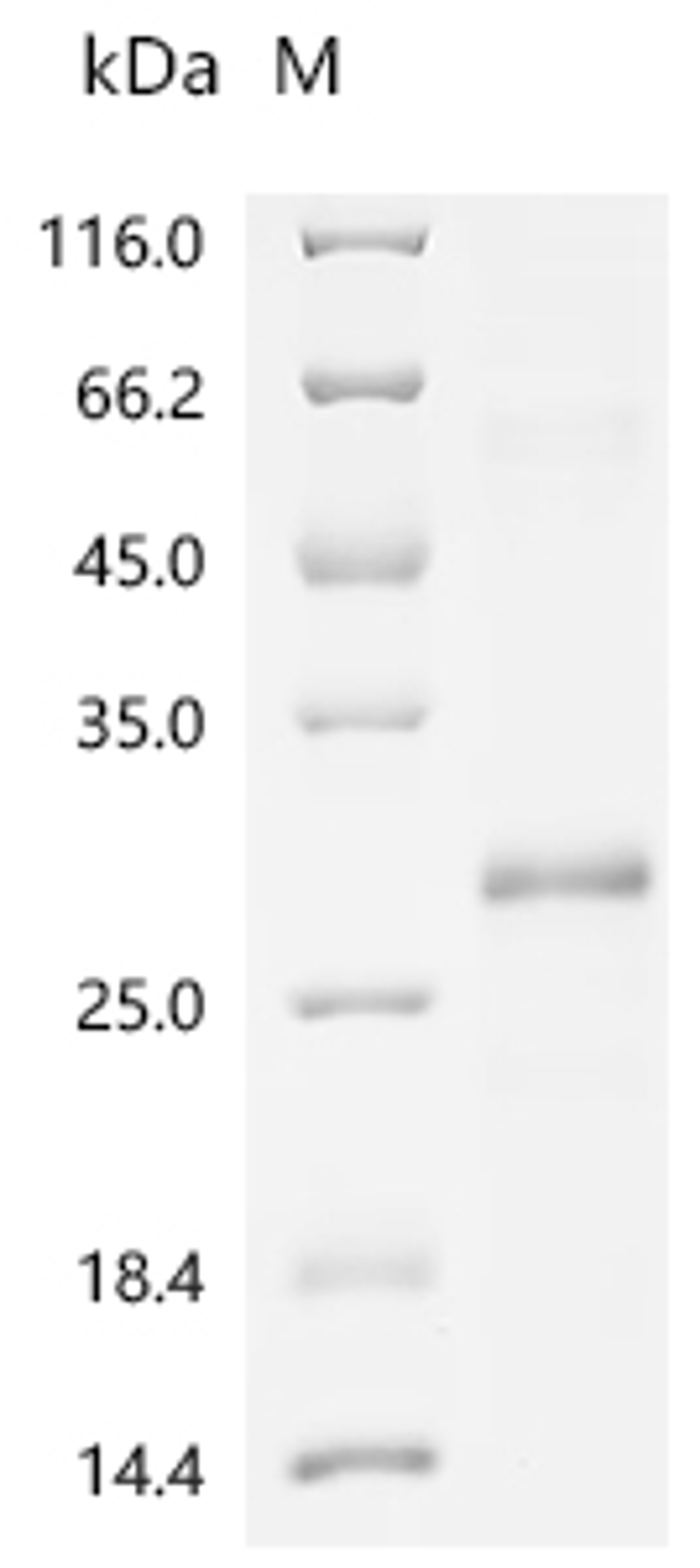 (Tris-Glycine gel) Discontinuous SDS-PAGE (reduced) with 5% enrichment gel and 15% separation gel.