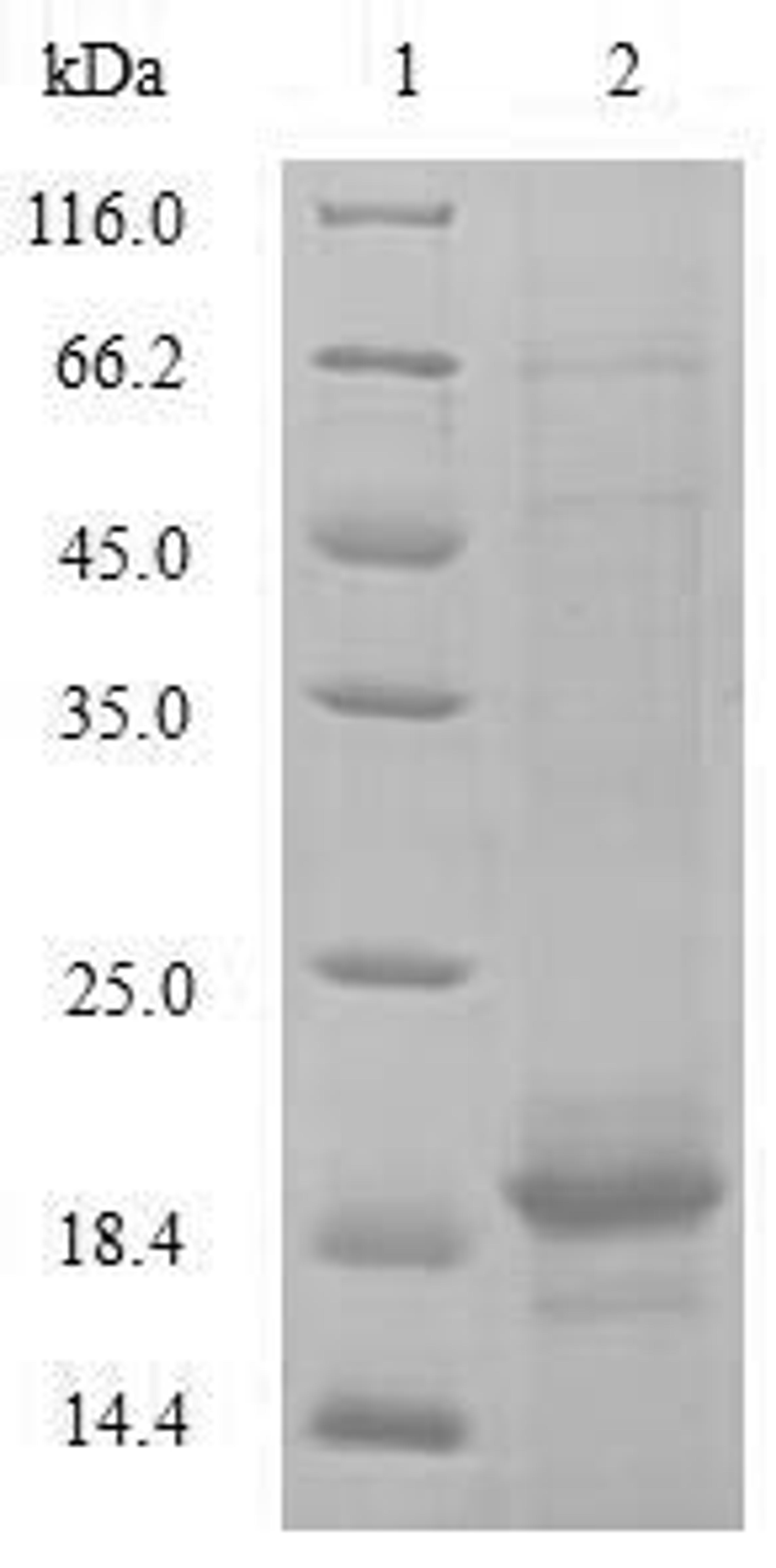 (Tris-Glycine gel) Discontinuous SDS-PAGE (reduced) with 5% enrichment gel and 15% separation gel.