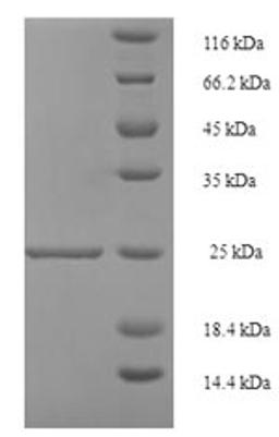 (Tris-Glycine gel) Discontinuous SDS-PAGE (reduced) with 5% enrichment gel and 15% separation gel.