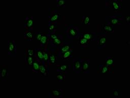 Immunofluorescence staining of Hela cells with CSB-PA010379OA179phHU at 1:25, counter-stained with DAPI. The cells were fixed in 4% formaldehyde, permeabilized using 0.2% Triton X-100 and blocked in 10% normal Goat Serum. The cells were then incubated with the antibody overnight at 4&deg;C. The secondary antibody was Alexa Fluor 488-congugated AffiniPure Goat Anti-Rabbit IgG(H+L).