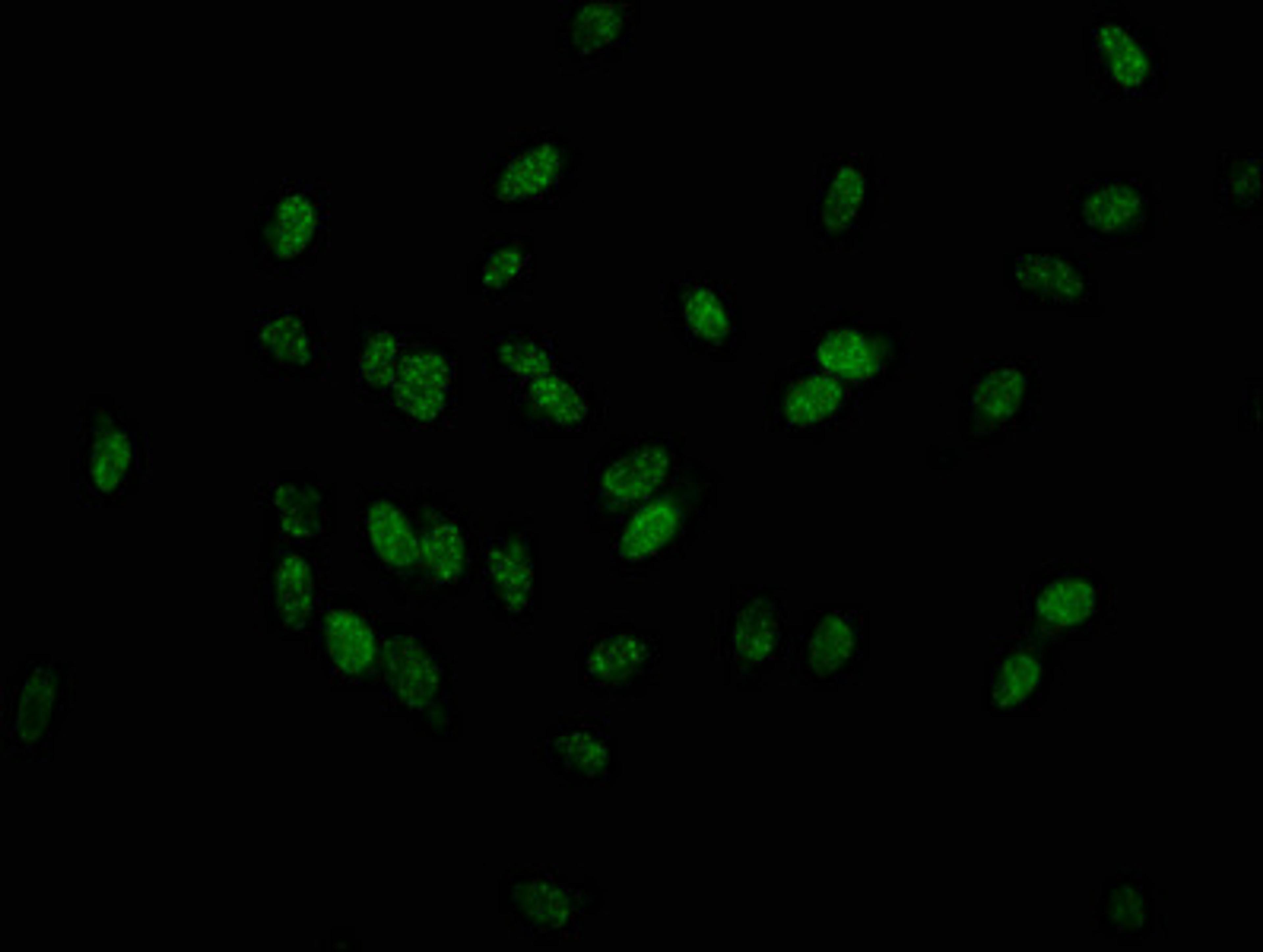 Immunofluorescence staining of Hela cells with CSB-PA010379OA179phHU at 1:25, counter-stained with DAPI. The cells were fixed in 4% formaldehyde, permeabilized using 0.2% Triton X-100 and blocked in 10% normal Goat Serum. The cells were then incubated with the antibody overnight at 4°C. The secondary antibody was Alexa Fluor 488-congugated AffiniPure Goat Anti-Rabbit IgG(H+L).