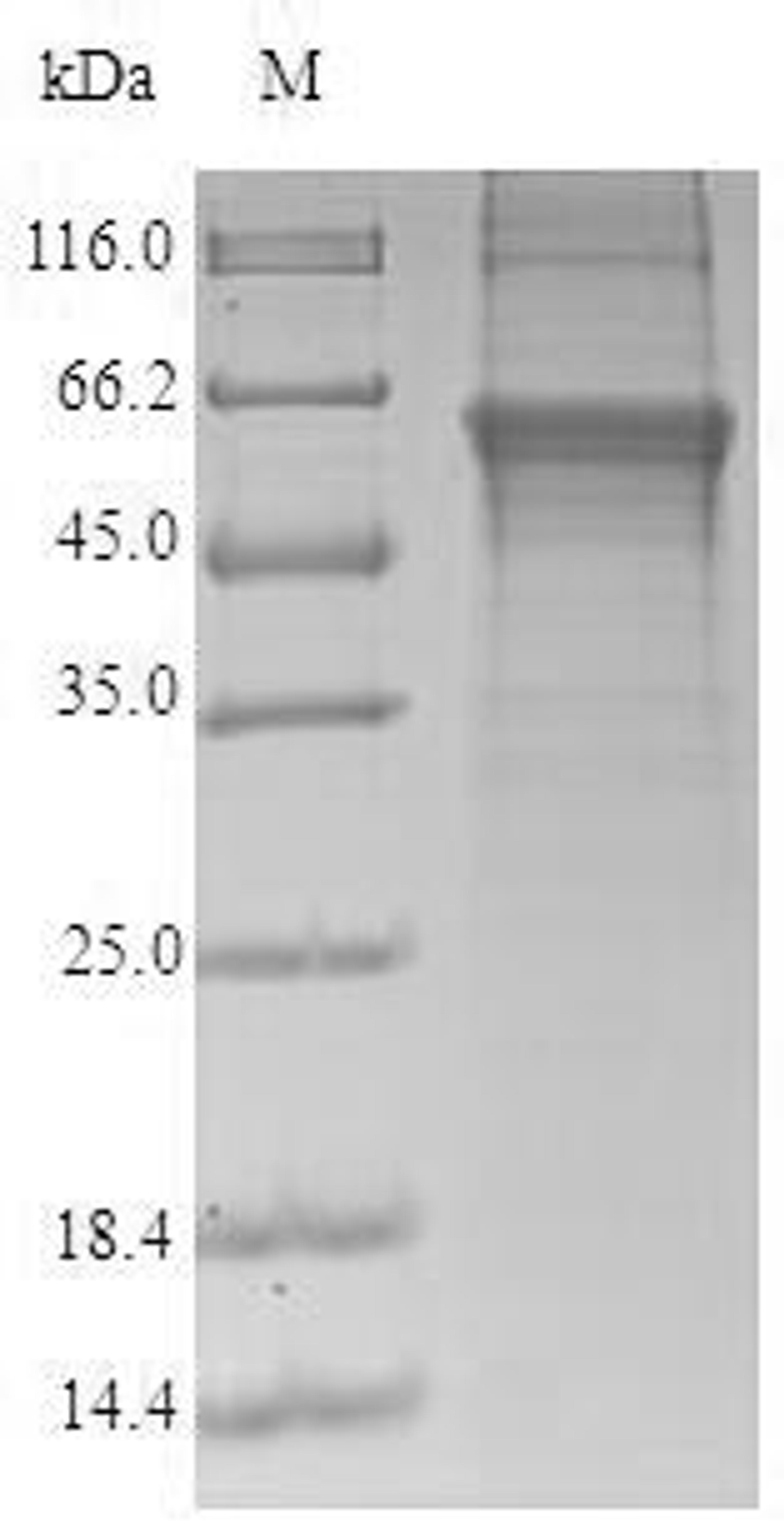 (Tris-Glycine gel) Discontinuous SDS-PAGE (reduced) with 5% enrichment gel and 15% separation gel.