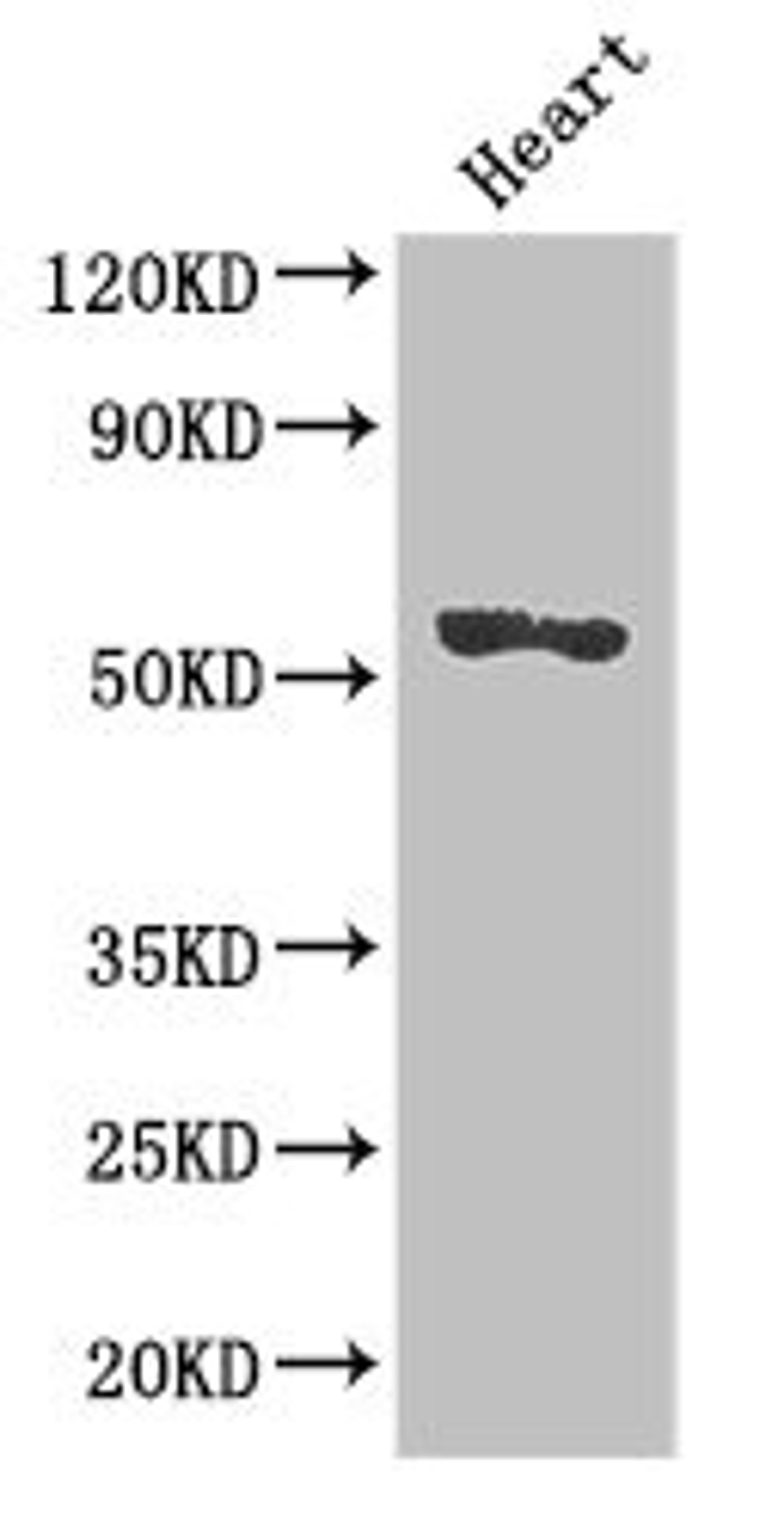 Western Blot. Positive WB detected in: Mouse heart tissue. All lanes: SRGAP2B antibody at 2.7ug/ml. Secondary. Goat polyclonal to rabbit IgG at 1/50000 dilution. Predicted band size: 54 kDa. Observed band size: 54 kDa. 