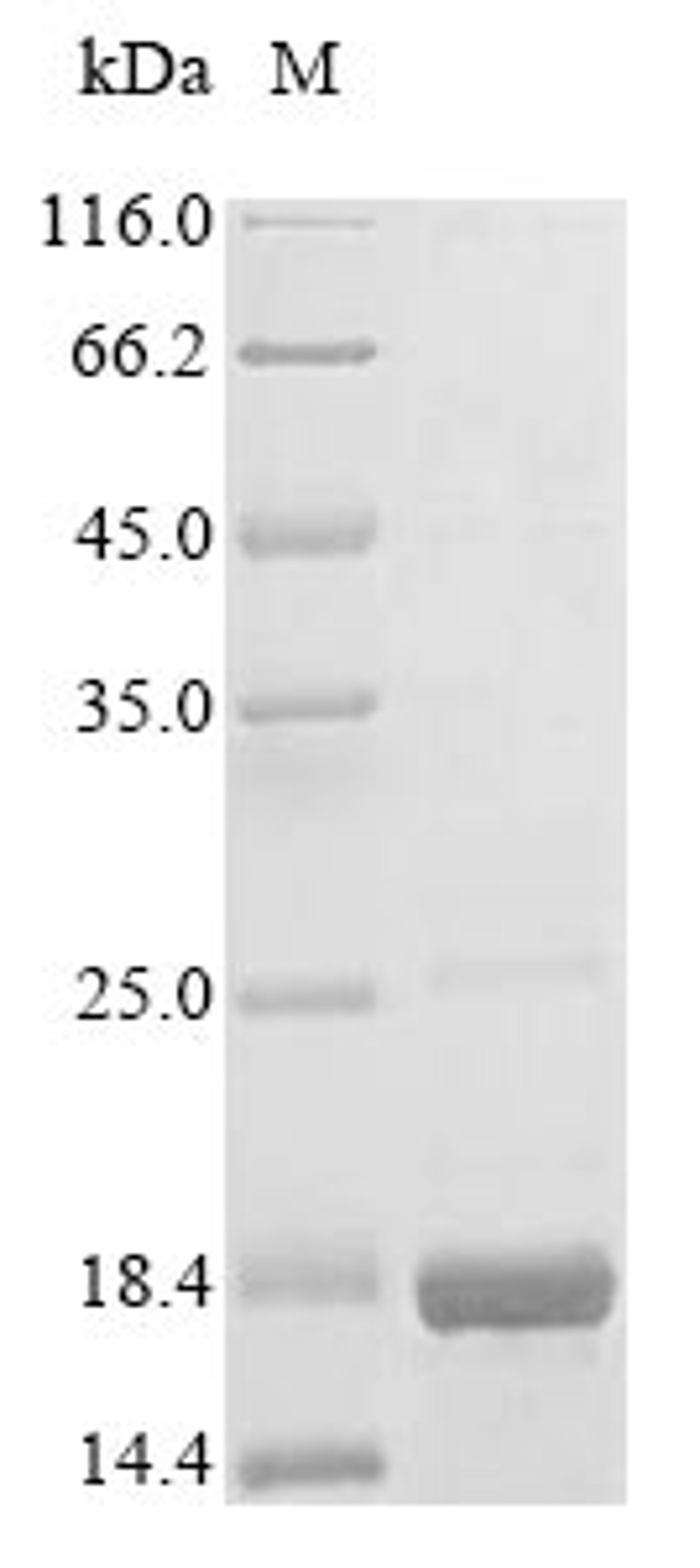 (Tris-Glycine gel) Discontinuous SDS-PAGE (reduced) with 5% enrichment gel and 15% separation gel.