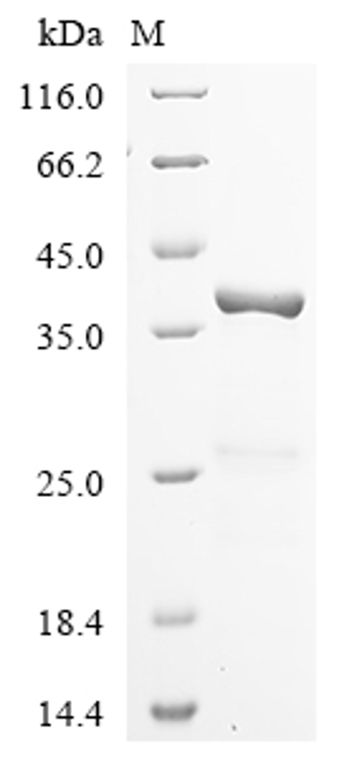 (Tris-Glycine gel) Discontinuous SDS-PAGE (reduced) with 5% enrichment gel and 15% separation gel.