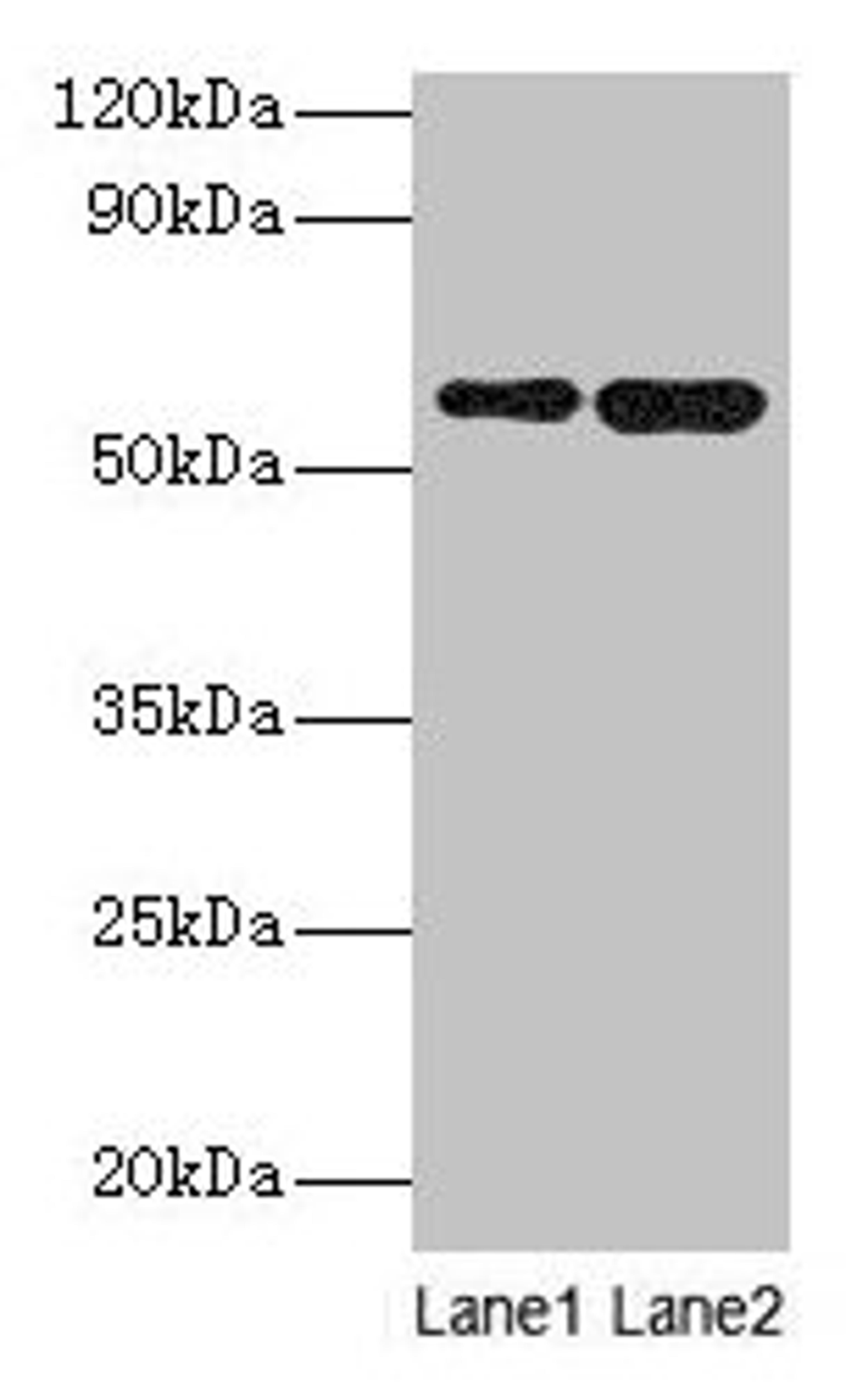 Western blot. All lanes: SCP2 antibody at 2µg/ml. Lane 1: A549 whole cell lysate. Lane 2: MCF-7 whole cell lysate. Secondary. Goat polyclonal to rabbit IgG at 1/10000 dilution. Predicted band size: 59, 16, 35, 51, 7, 55, 57 kDa. Observed band size: 59 kDa
