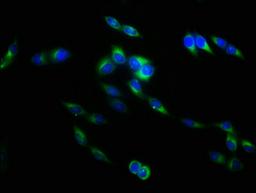 Immunofluorescence staining of Hela cells with CSB-PA08047A0Rb at 1:133, counter-stained with DAPI. The cells were fixed in 4% formaldehyde, permeabilized using 0.2% Triton X-100 and blocked in 10% normal Goat Serum. The cells were then incubated with the antibody overnight at 4°C. The secondary antibody was Alexa Fluor 488-congugated AffiniPure Goat Anti-Rabbit IgG(H+L).