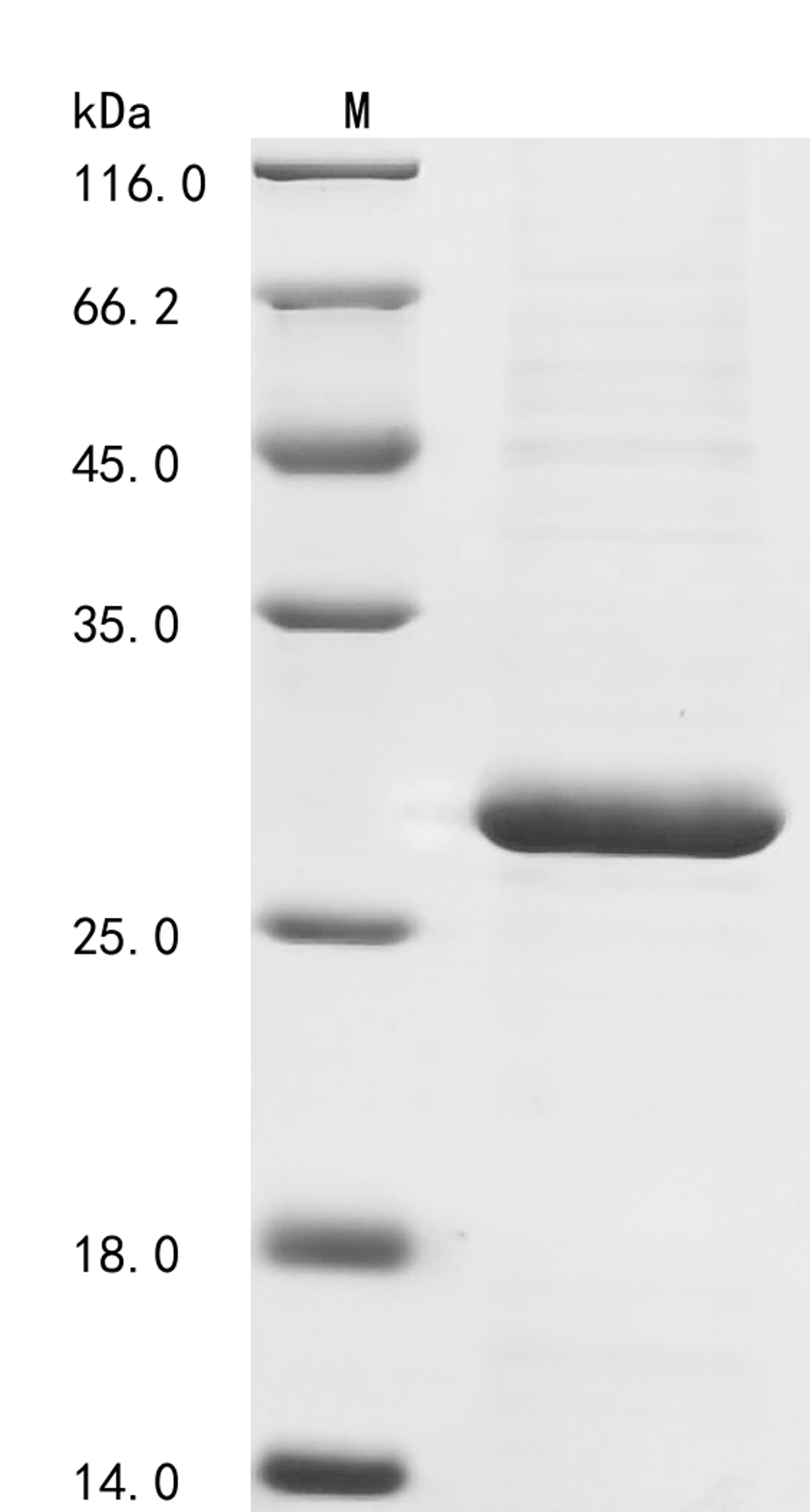 (Tris-Glycine gel) Discontinuous SDS-PAGE (reduced) with 5% enrichment gel and 15% separation gel.