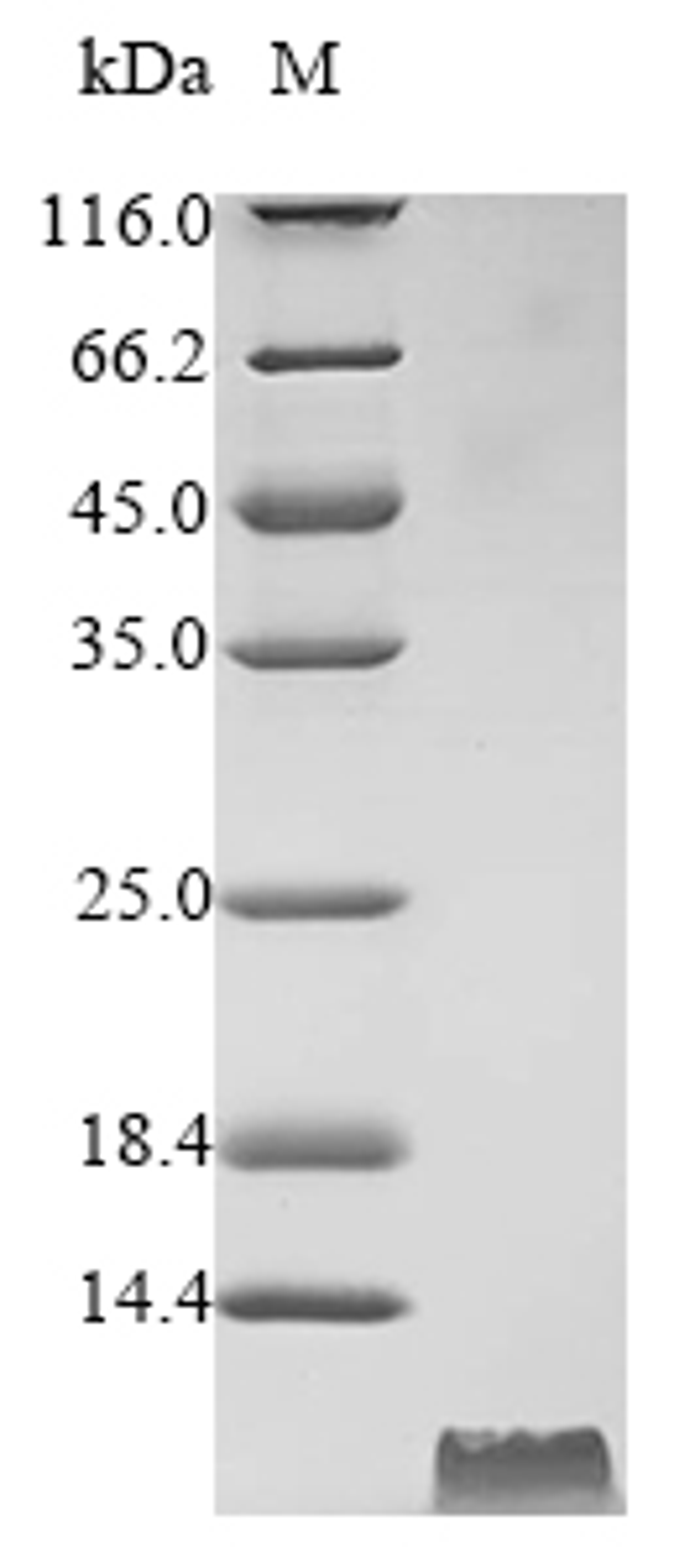 (Tris-Glycine gel) Discontinuous SDS-PAGE (reduced) with 5% enrichment gel and 15% separation gel.