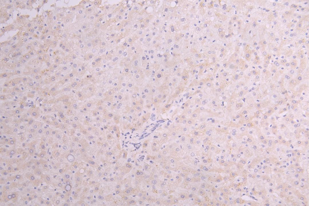 IHC image of CSB-RA010327MA1HU diluted at 1:100 and staining in paraffin-embedded human Liver tissue performed on a Leica BondTM system. After dewaxing and hydration, antigen retrieval was mediated by high pressure in a citrate buffer (pH 6.0). Section was blocked with 10% normal goat serum 30min at RT. Then primary antibody (1% BSA) was incubated at 4°C overnight. The primary is detected by a Goat anti-Human IgG labeled by HRP and visualized using 0.05% DAB.