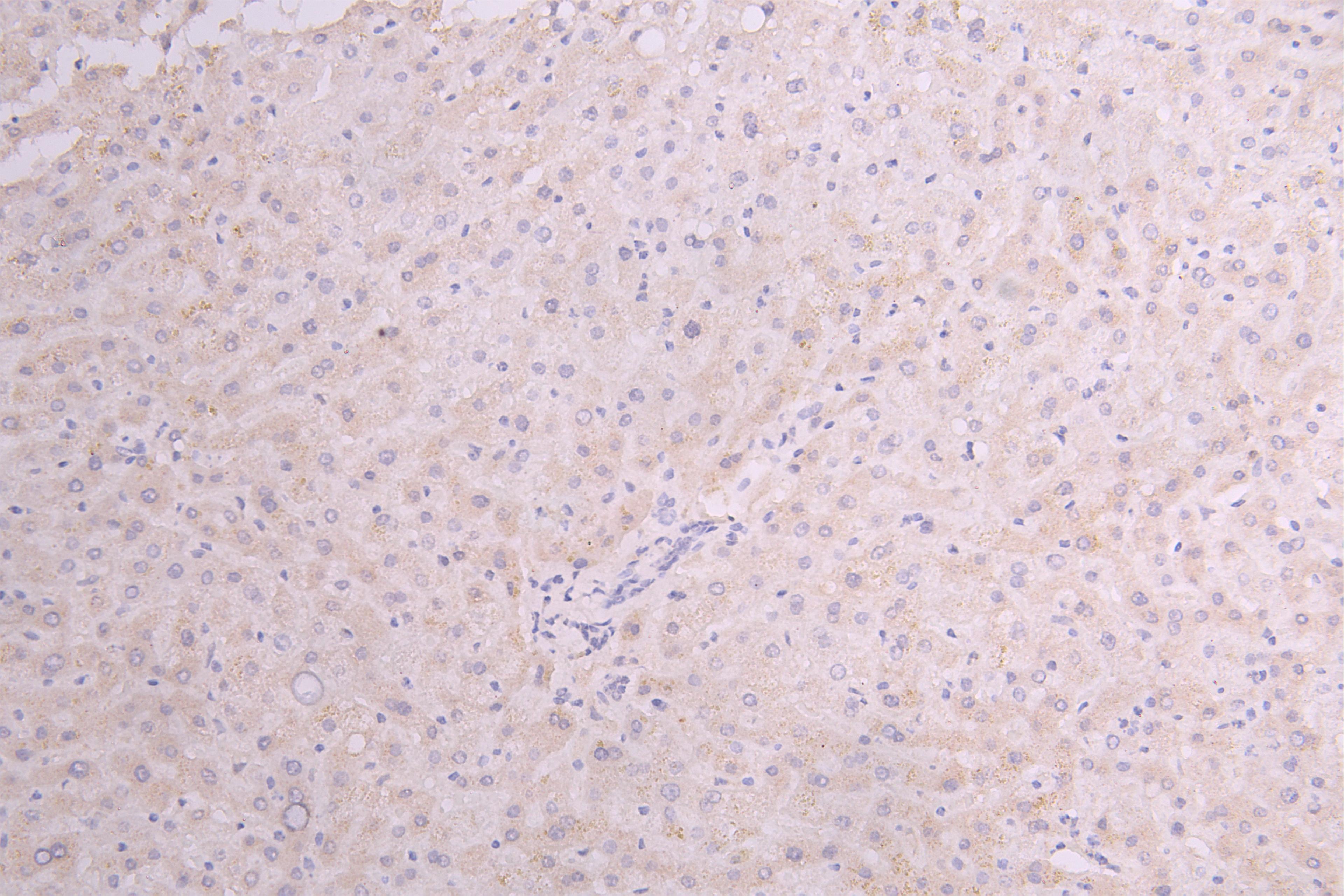 IHC image of CSB-RA010327MA1HU diluted at 1:100 and staining in paraffin-embedded human Liver tissue performed on a Leica BondTM system. After dewaxing and hydration, antigen retrieval was mediated by high pressure in a citrate buffer (pH 6.0). Section was blocked with 10% normal goat serum 30min at RT. Then primary antibody (1% BSA) was incubated at 4°C overnight. The primary is detected by a Goat anti-Human IgG labeled by HRP and visualized using 0.05% DAB.