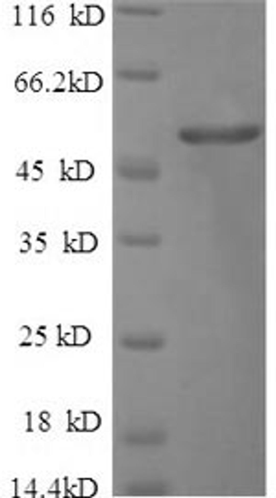 (Tris-Glycine gel) Discontinuous SDS-PAGE (reduced) with 5% enrichment gel and 15% separation gel.