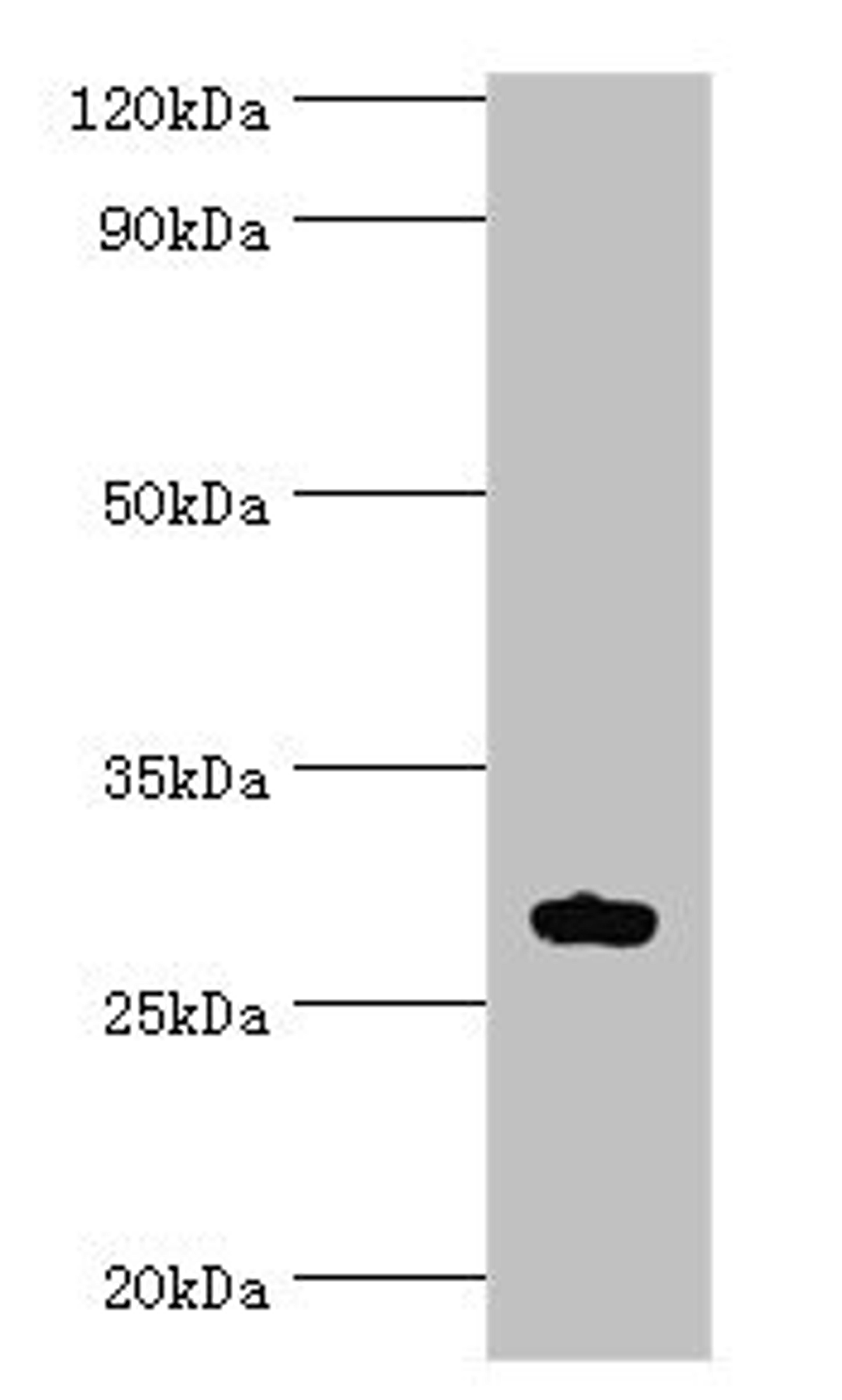 Western blot. All lanes: ATF1 antibody at 10ug/ml + Mouse liver tissue. Secondary. Goat polyclonal to rabbit IgG at 1/10000 dilution. Predicted band size: 30, 16 kDa. Observed band size: 30 kDa. 