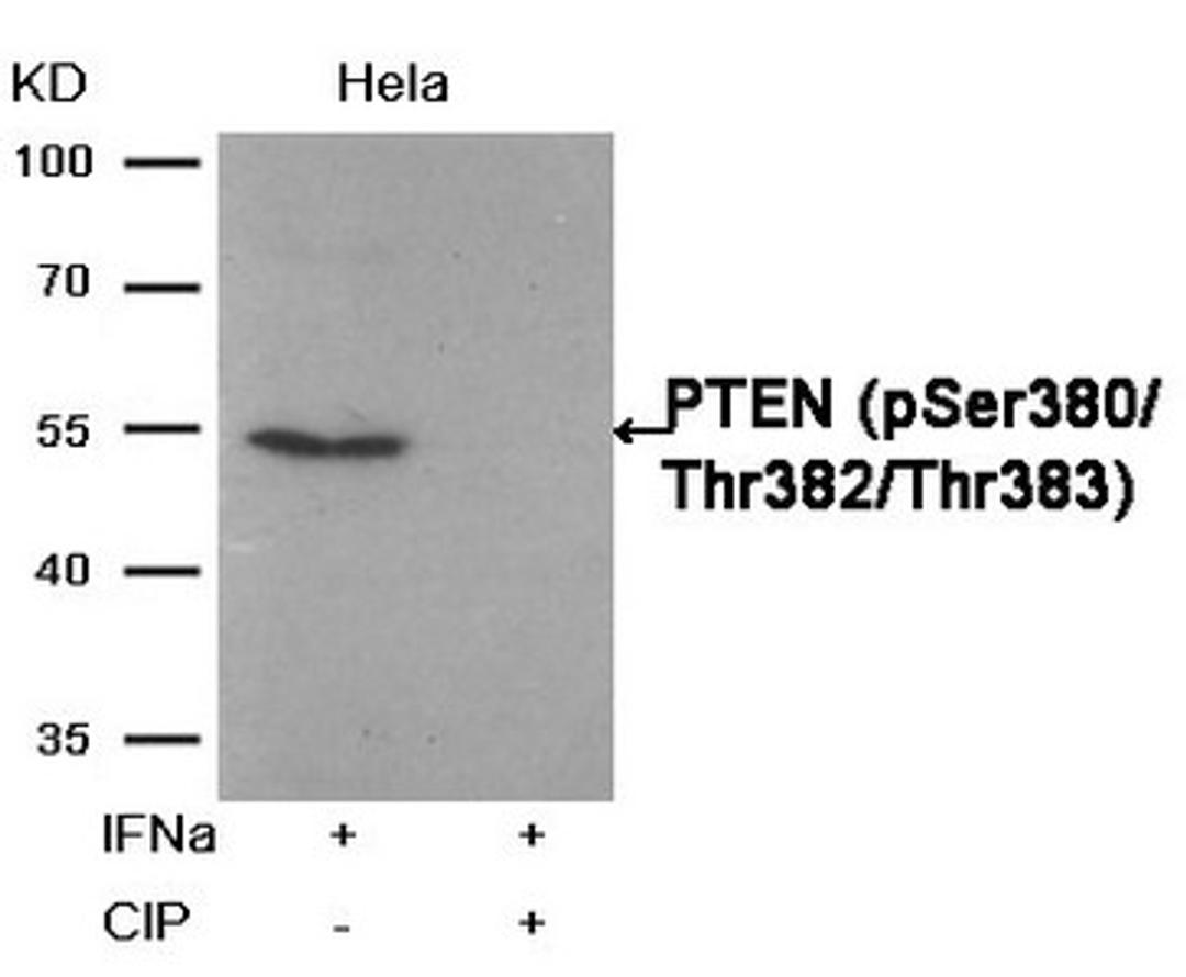 Western blot analysis of extracts from Hela cells, treated with IFNa or calf intestinal phosphatase (CIP), using PTEN (Phospho-Ser380/Thr382/Thr383) Antibody.