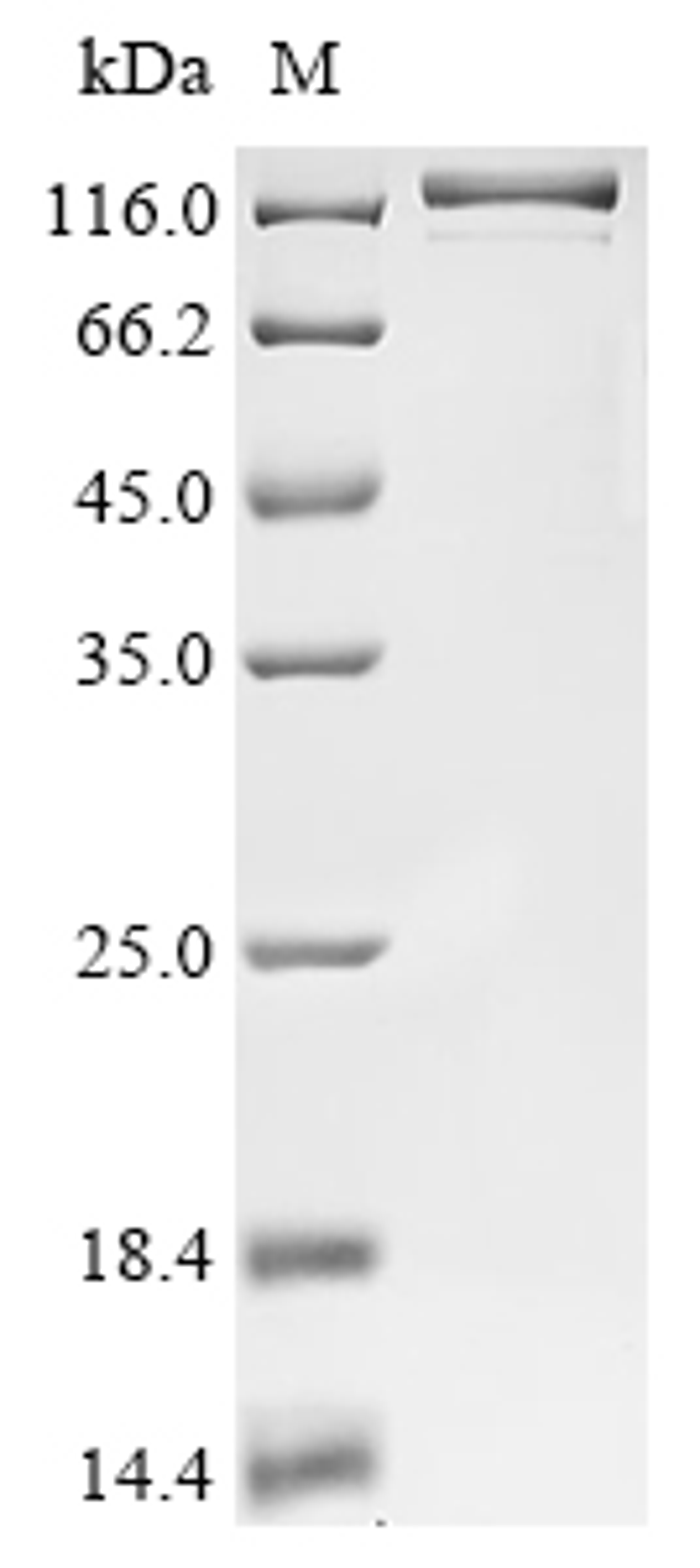 (Tris-Glycine gel) Discontinuous SDS-PAGE (reduced) with 5% enrichment gel and 15% separation gel.