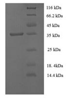 (Tris-Glycine gel) Discontinuous SDS-PAGE (reduced) with 5% enrichment gel and 15% separation gel.