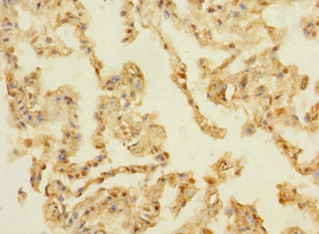Immunohistochemistry of paraffin-embedded human lung tissue using CSB-PA889141LA01HU at dilution of 1:100