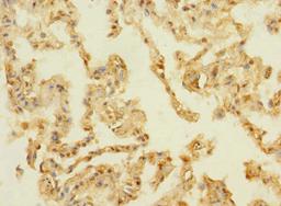 Immunohistochemistry of paraffin-embedded human lung tissue using CSB-PA889141LA01HU at dilution of 1:100