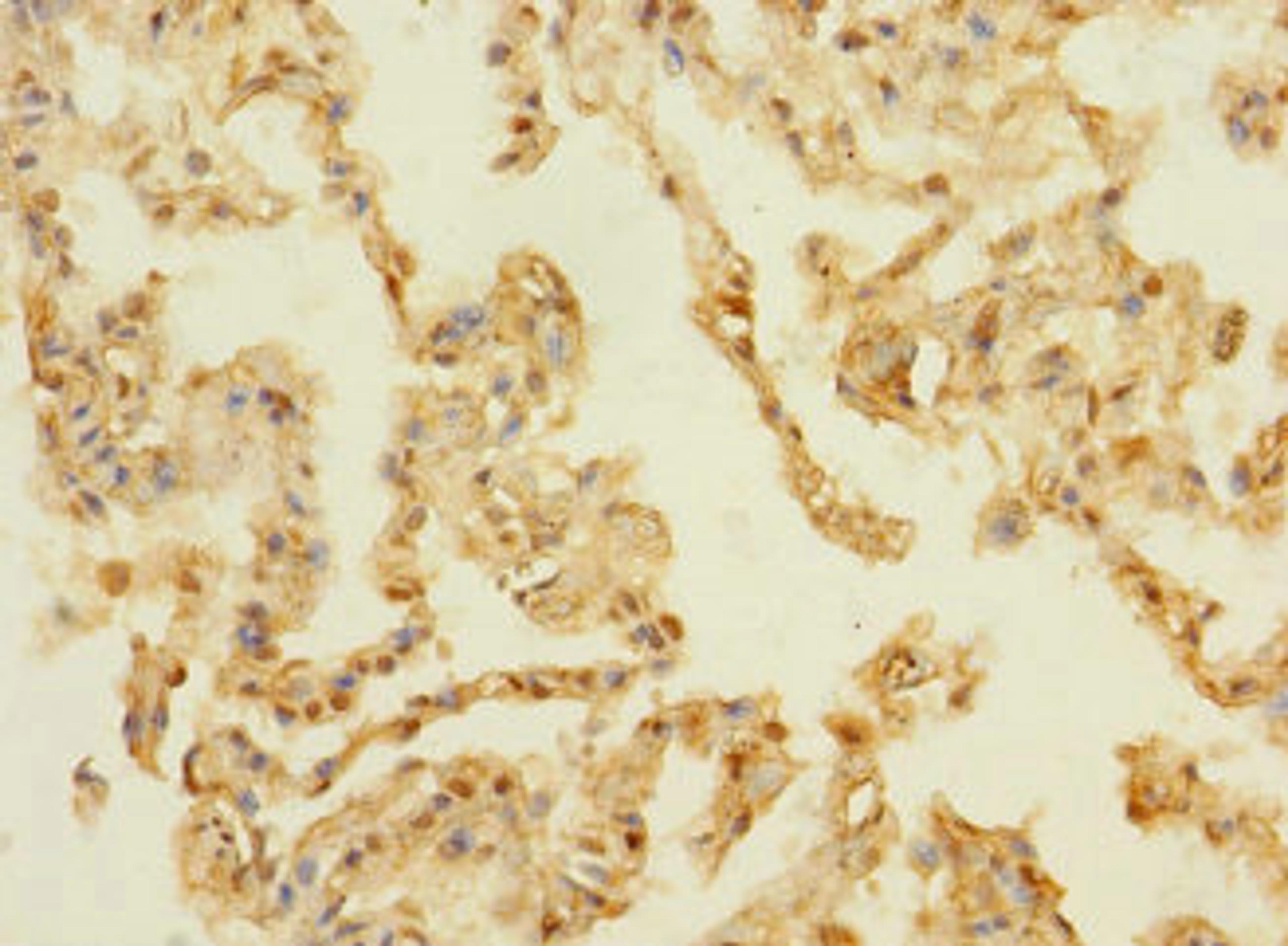 Immunohistochemistry of paraffin-embedded human lung tissue using CSB-PA889141LA01HU at dilution of 1:100