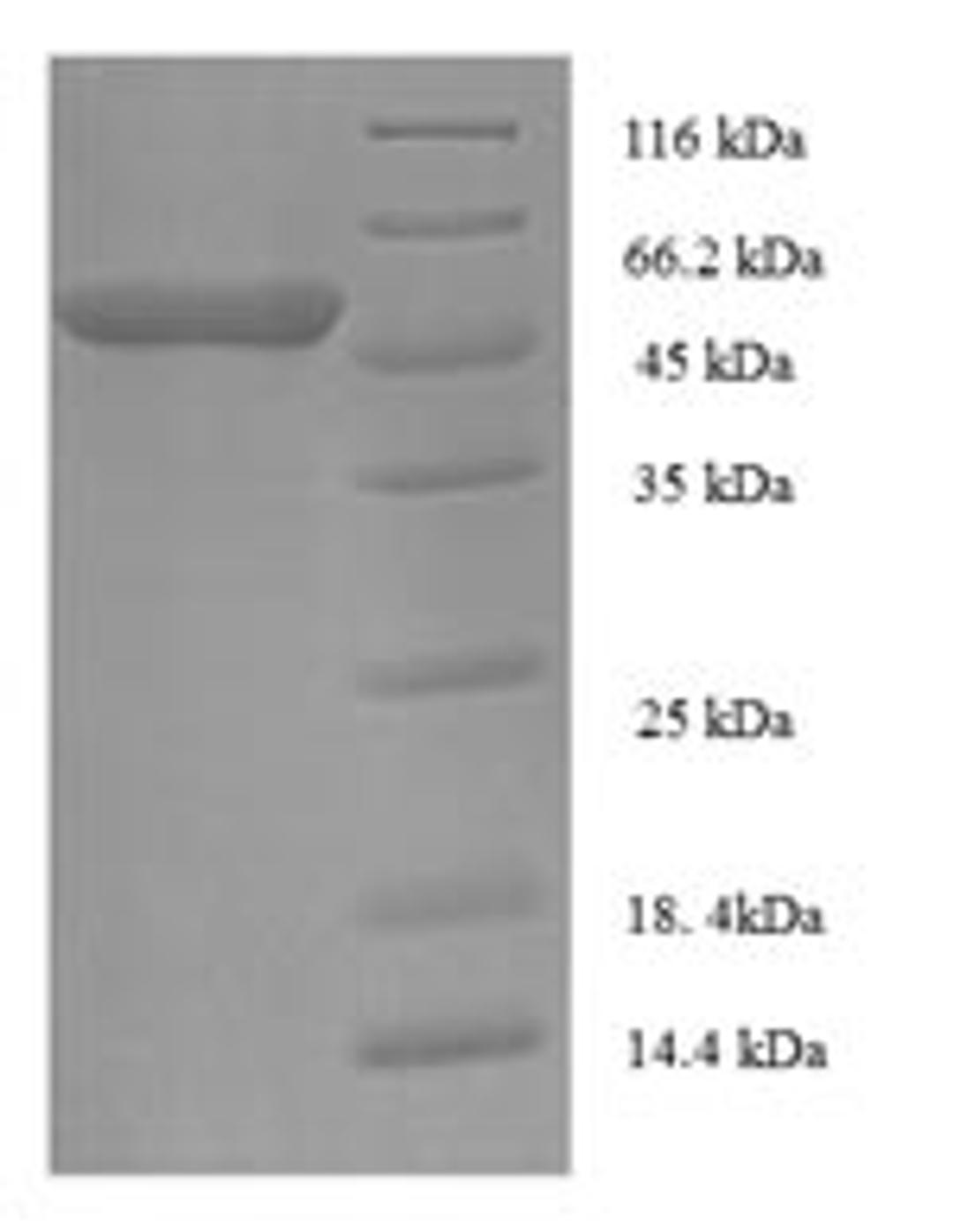 (Tris-Glycine gel) Discontinuous SDS-PAGE (reduced) with 5% enrichment gel and 15% separation gel.