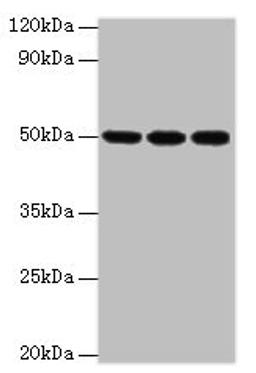 Western blot. All lanes: HAT1 antibody at 3µg/ml. Lane 1: MCF-7 whole cell lysate. Lane 2: 293T whole cell lysate. Lane 3: HepG2 whole cell lysate. Secondary. Goat polyclonal to rabbit at 1/10000 dilution. Predicted band size: 50, 40 kDa. Observed band size: 50 kDa