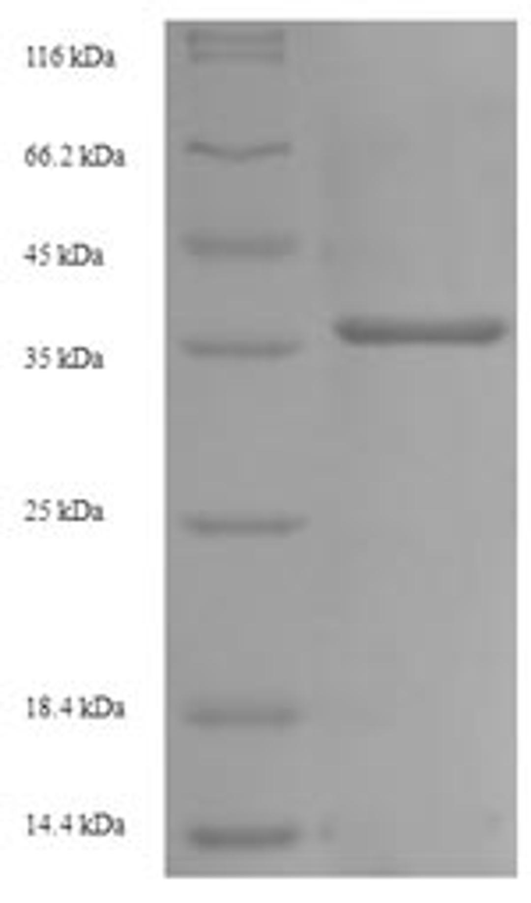 (Tris-Glycine gel) Discontinuous SDS-PAGE (reduced) with 5% enrichment gel and 15% separation gel.