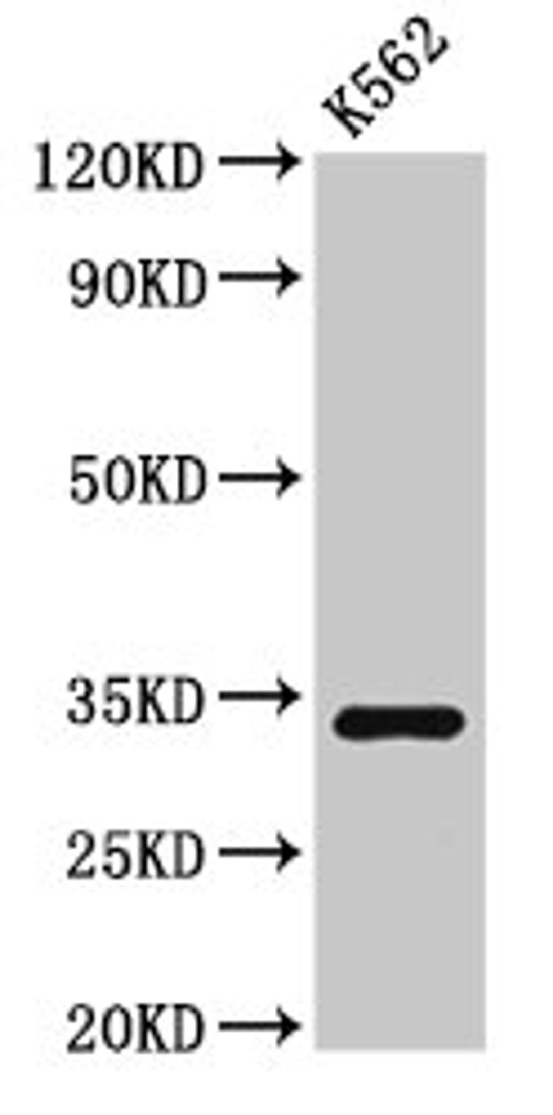 Western Blot. Positive WB detected in: K562 whole cell lysate. All lanes: SET antibody at 3µg/ml. Secondary. Goat polyclonal to rabbit IgG at 1/50000 dilution. Predicted band size: 34, 33, 31, 32 kDa. Observed band size: 34 kDa