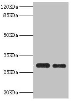 Western blot. All lanes: PSME1 antibody at 0.75µg/ml. Lane 1: Mouse liver tissue. Lane 2: Raji whole cell lysate. Secondary. Goat polyclonal to rabbit IgG at 1/10000 dilution. Predicted band size: 29, 27 kDa. Observed band size: 29 kDa