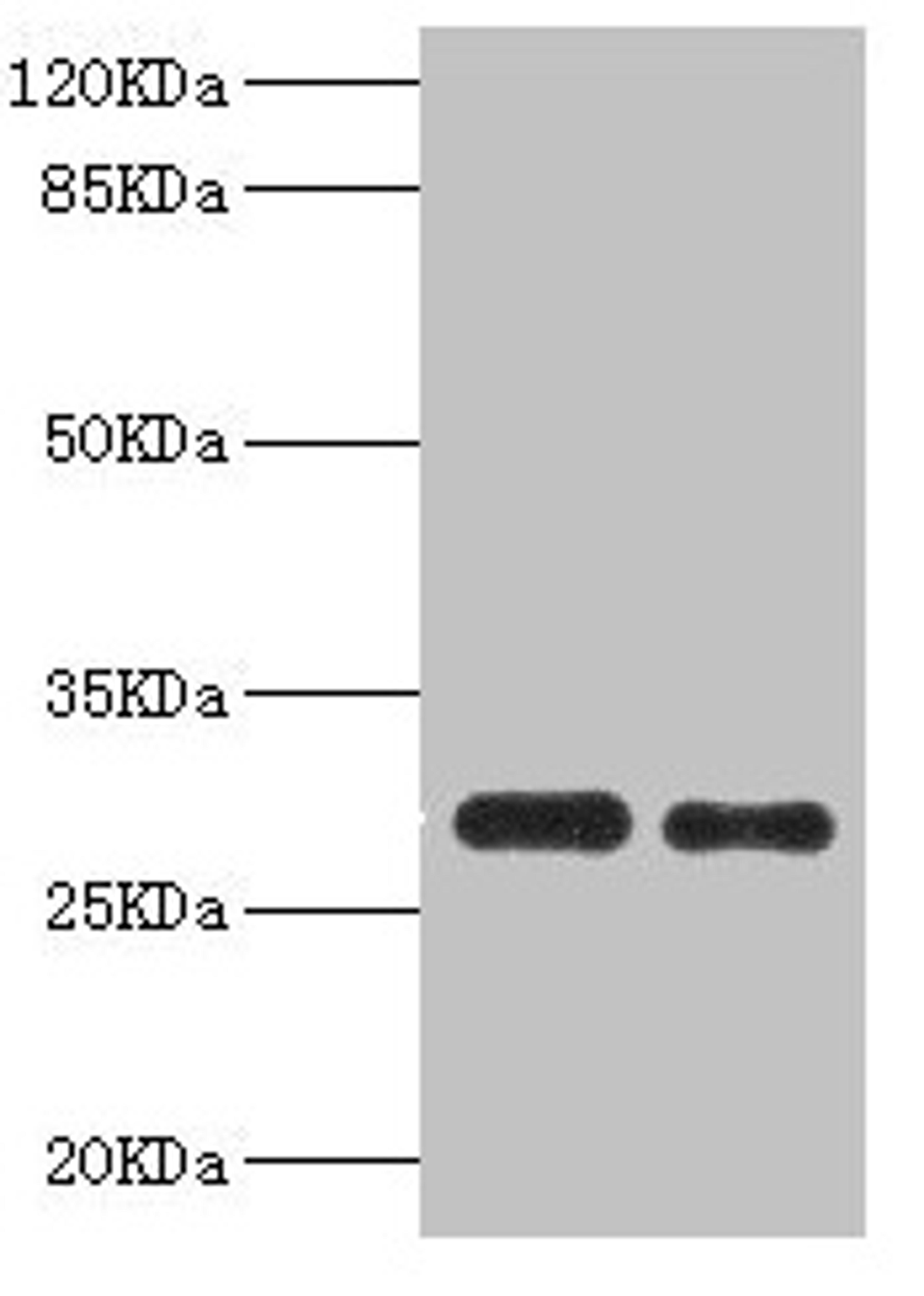 Western blot. All lanes: PSME1 antibody at 0.75µg/ml. Lane 1: Mouse liver tissue. Lane 2: Raji whole cell lysate. Secondary. Goat polyclonal to rabbit IgG at 1/10000 dilution. Predicted band size: 29, 27 kDa. Observed band size: 29 kDa