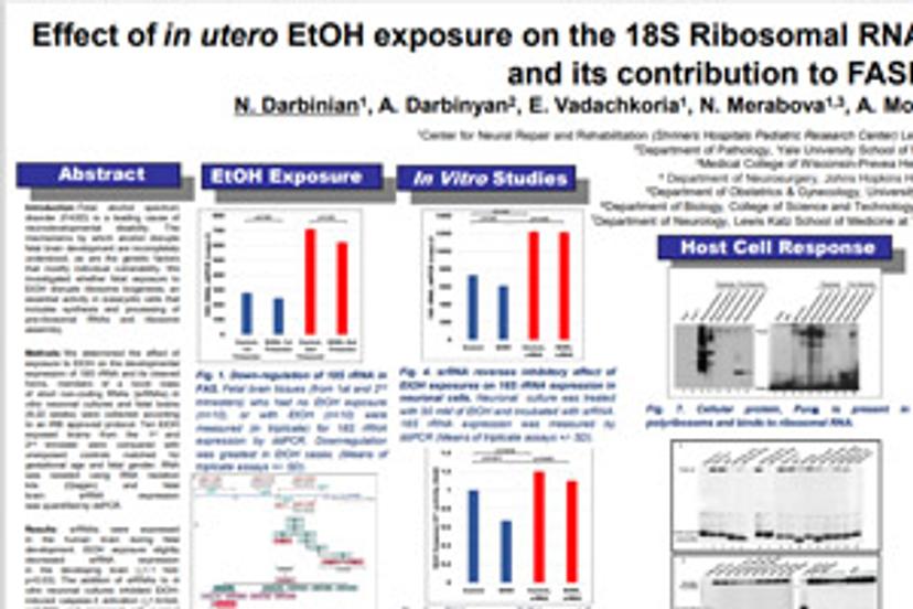 Effect of in utero EtOH exposure on the 18S Ribosomal RNA processing in developing brain, and its contribution to FASD