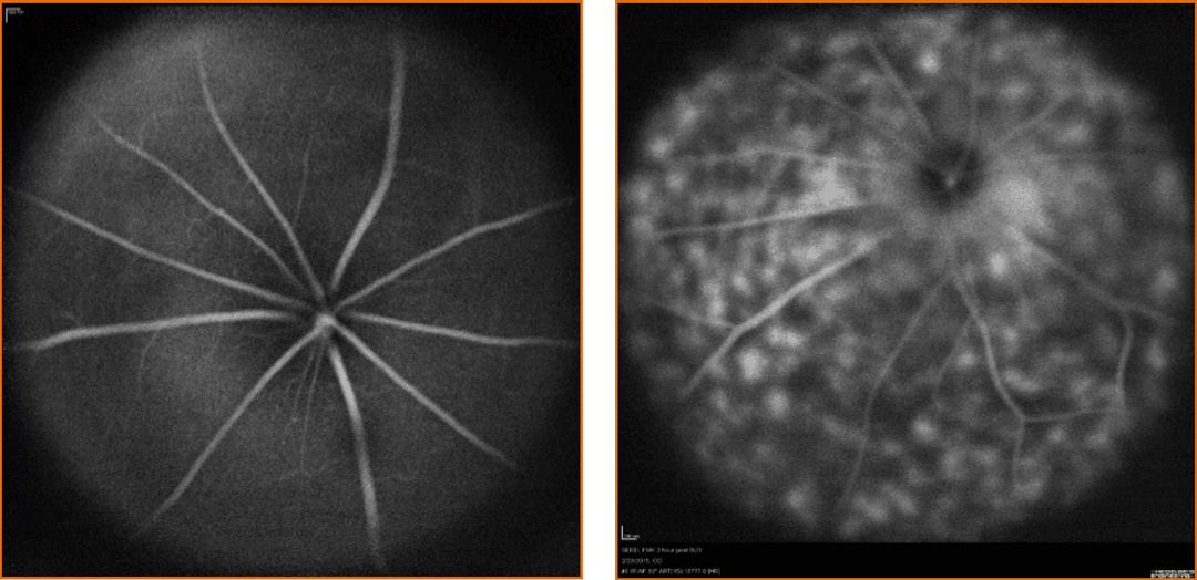 In vivo imaging of cell death in RPE