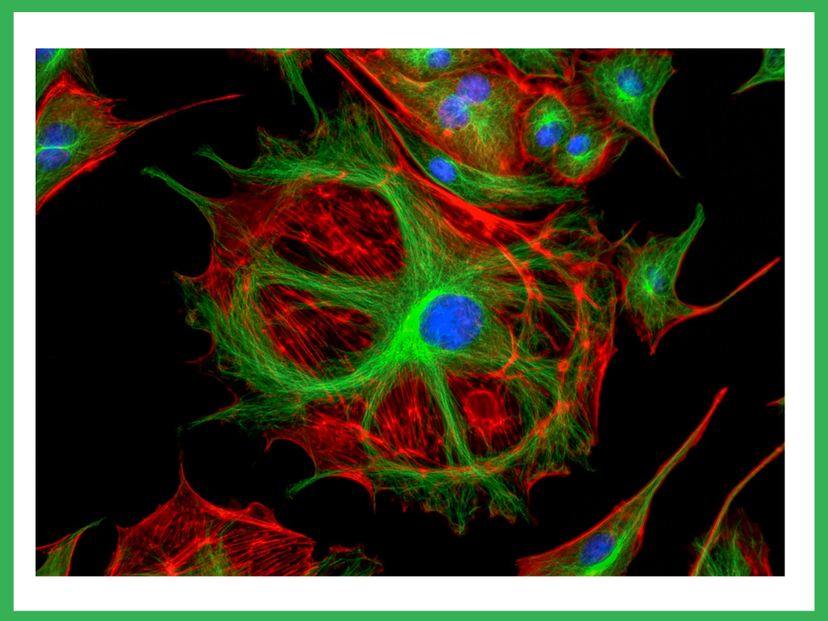 Efficient direct translocation of proteins into living cells using BioPORTER® protein delivery reagent