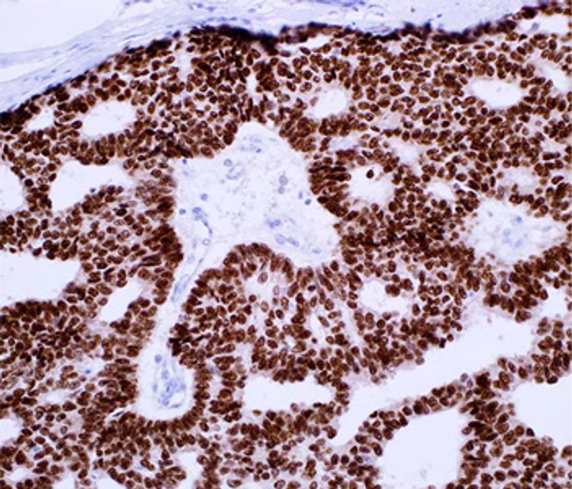 GATA3 (L50-823) on breast tissue