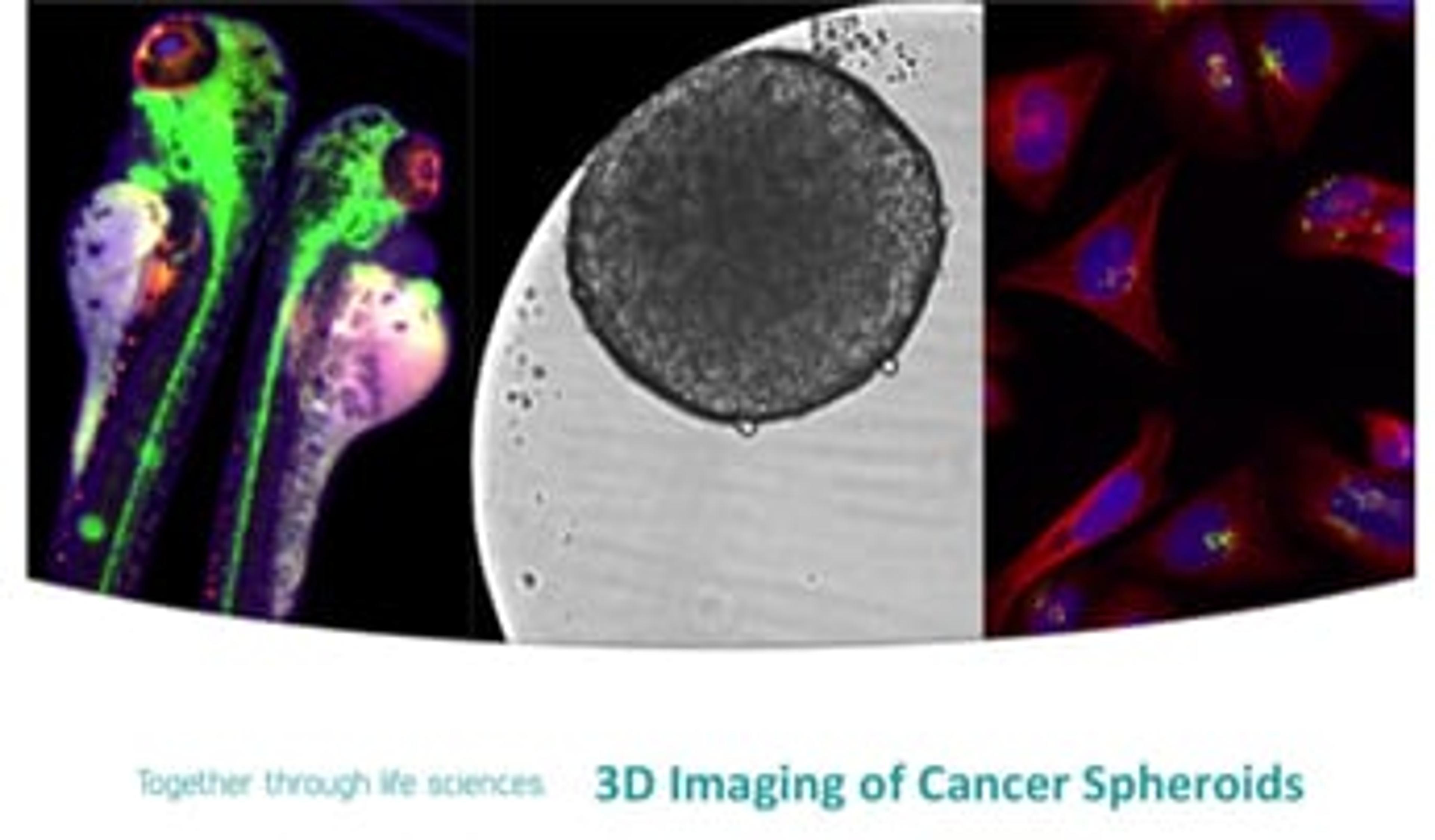 3D Imaging of Cancer Spheroids with the ImageXpress Micro XLS System from Molecular Devices® 3D Imaging of Cancer Spheroids with the ImageXpress Micro XLS System from Molecular Devices®