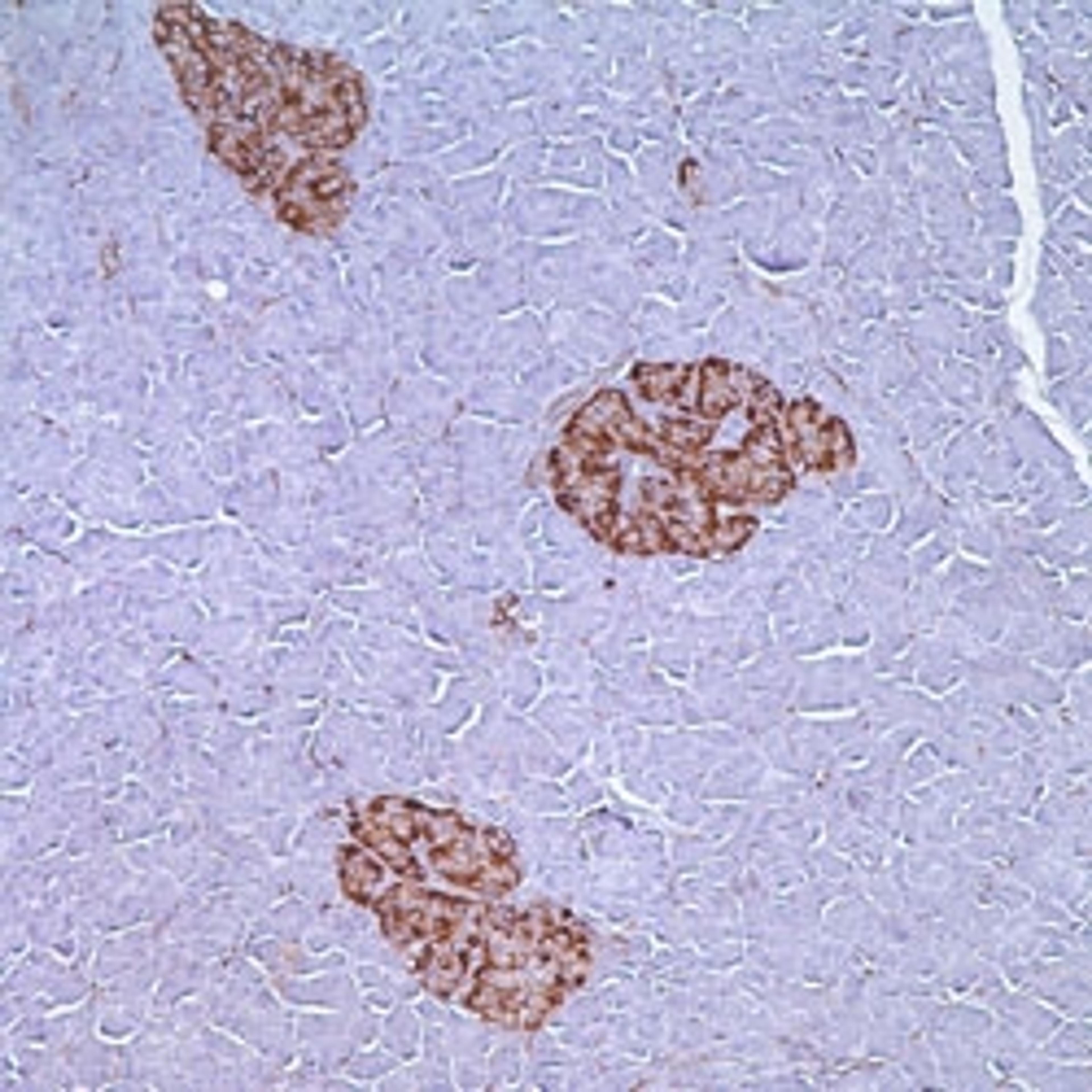 CD56 (MRQ-42) on pancreas.