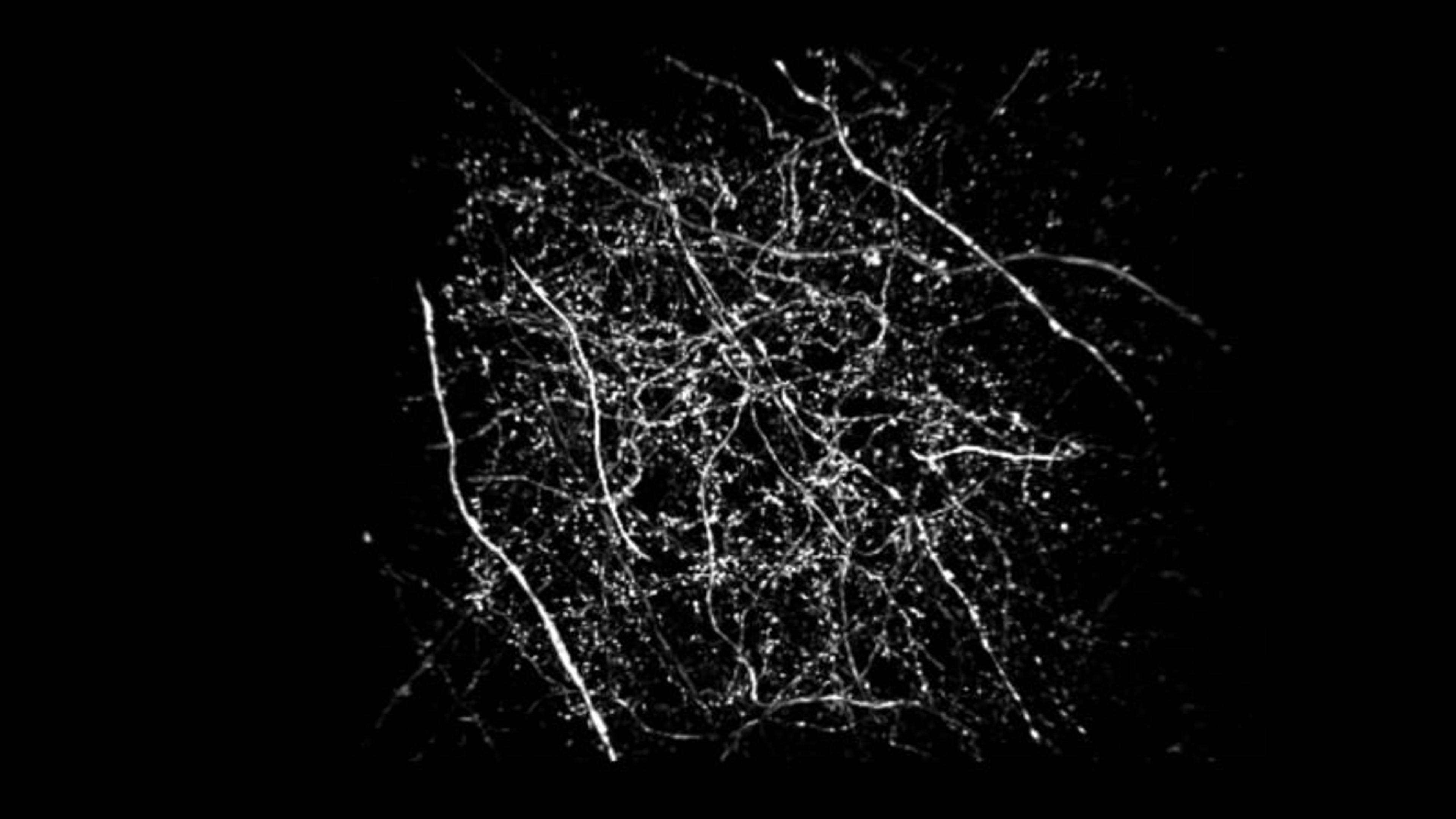 DeepSIM super-resolution acquisition DeepSIM super-resolution acquisition
