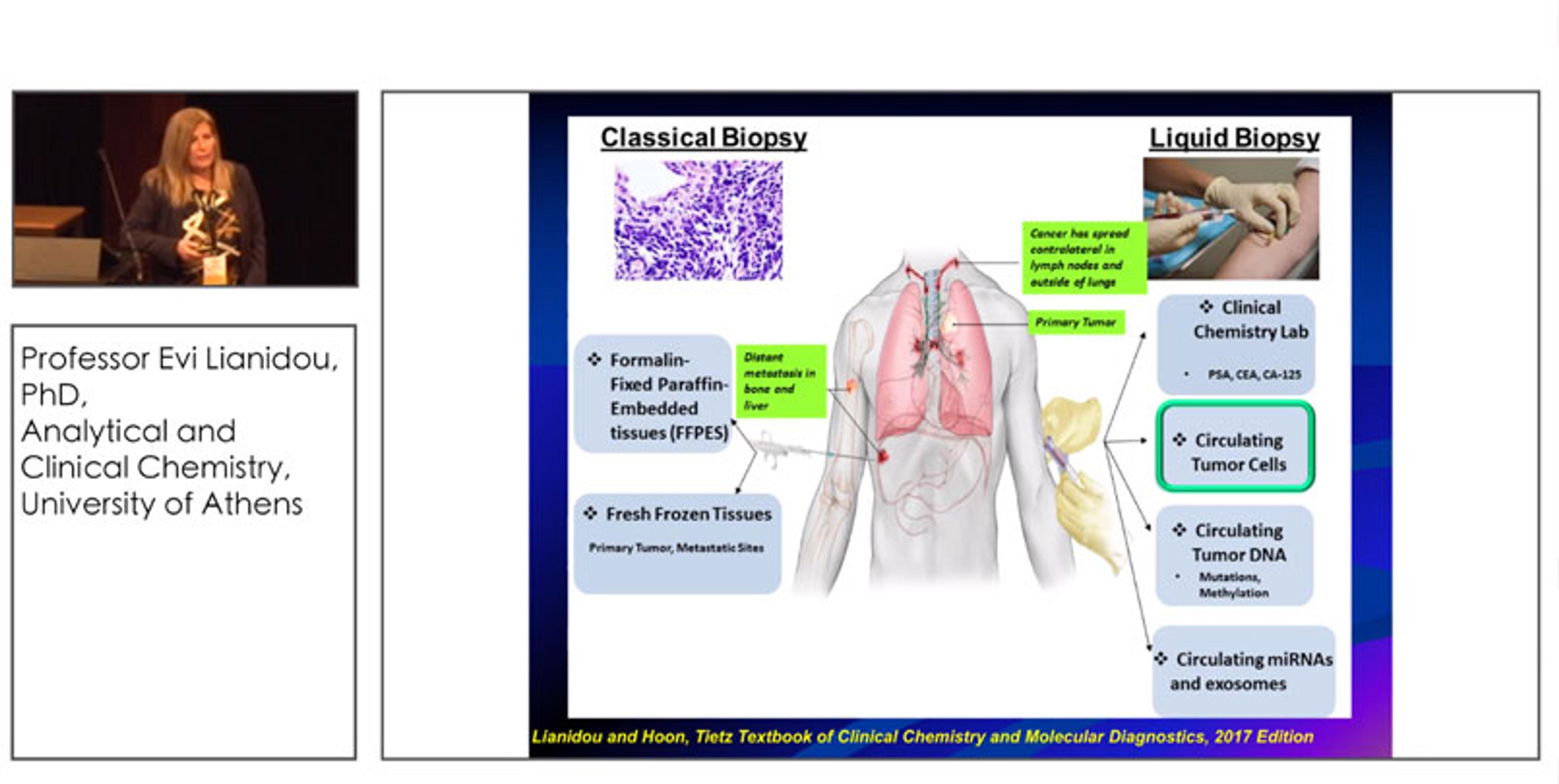 Pre-empting Metastases by Characterizing and Enumerating Circulating Tumor Cells at the Single-Cell Level Pre-empting Metastases by Characterizing and Enumerating Circulating Tumor Cells at the Single-Cell Level