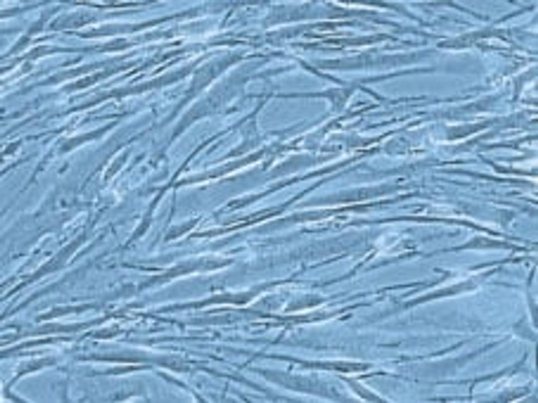 Human smooth muscle cells