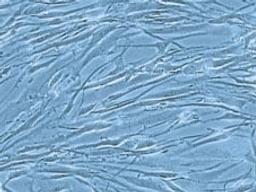 Human smooth muscle cells