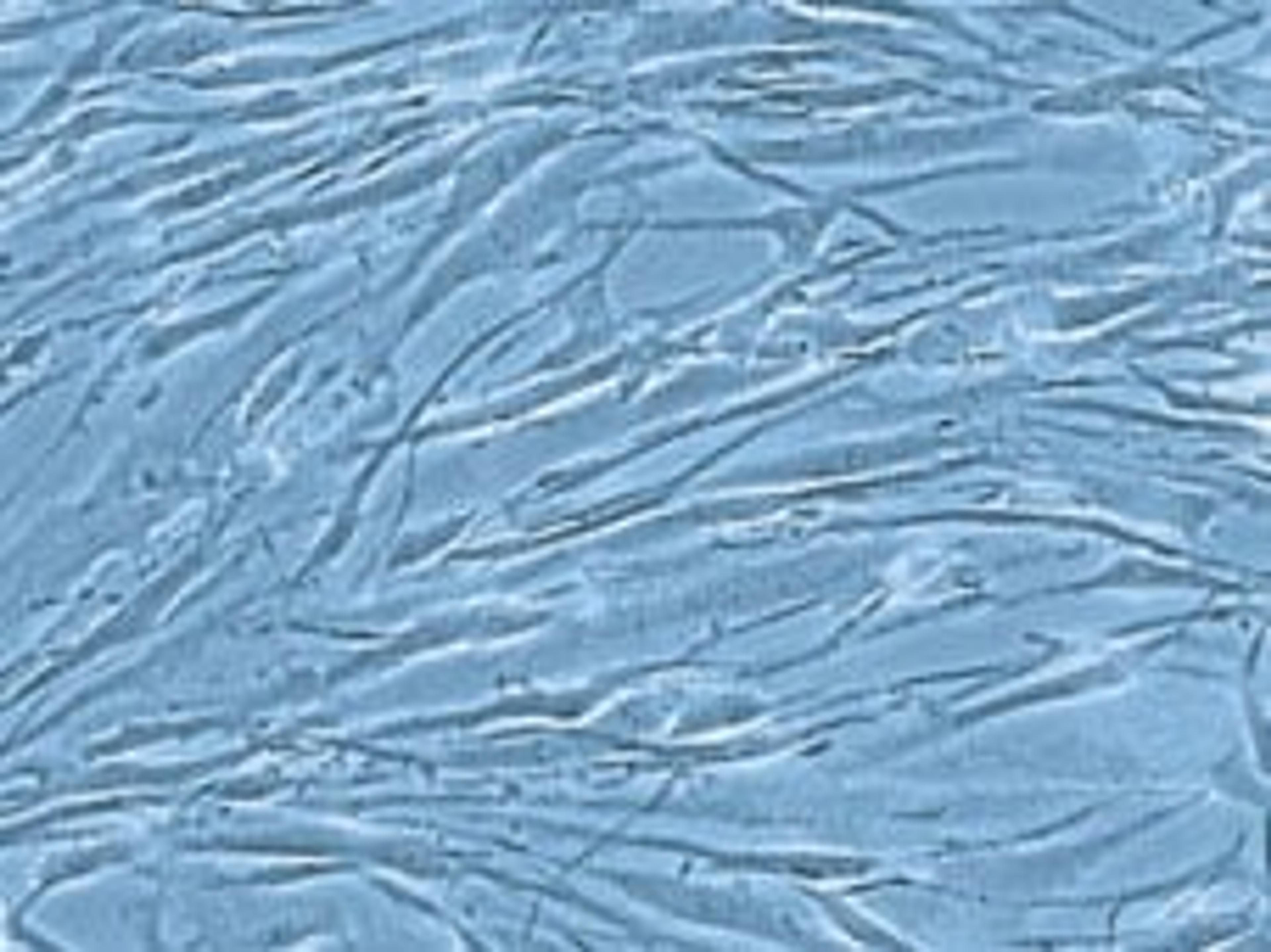 Human smooth muscle cells