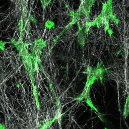 Migrating cells in 3D Collagen matrix