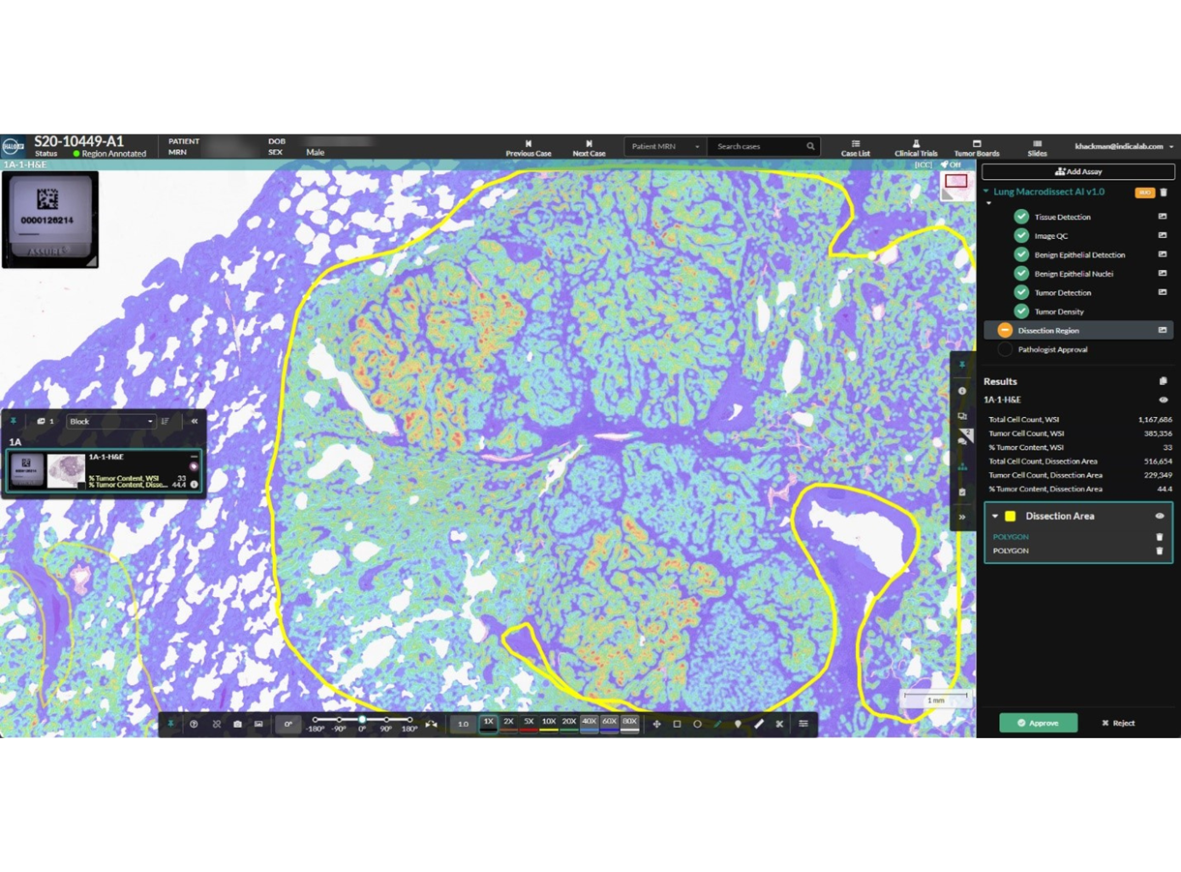 Lung Macrodissect AI is seamlessly deployed in HALO AP®