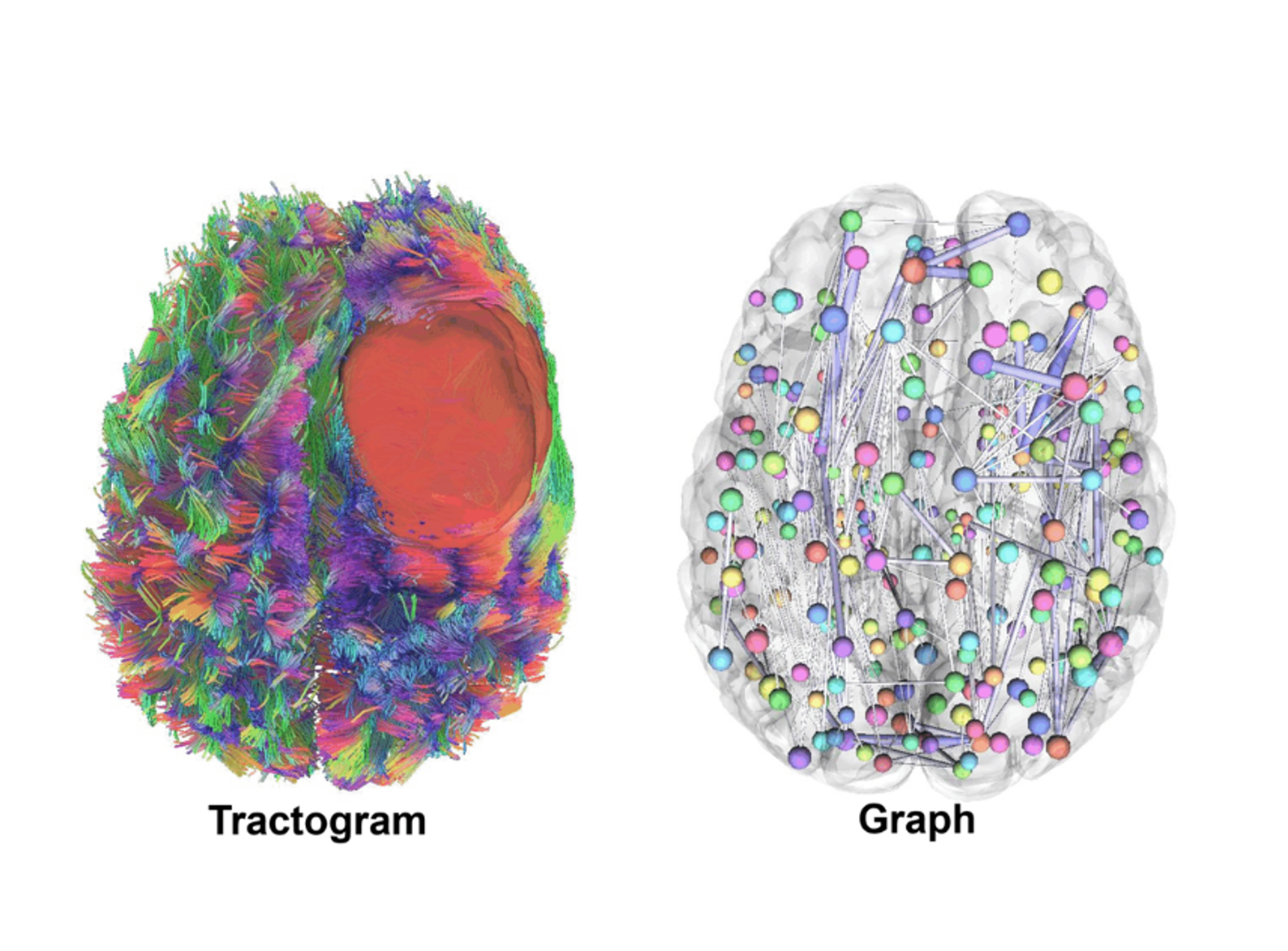 MRI-based reconstruction of brain connections (left) and their simplified network representation (right)