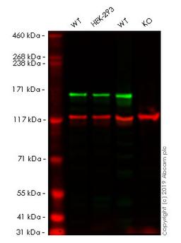 WB - MSH6 knockout HeLa