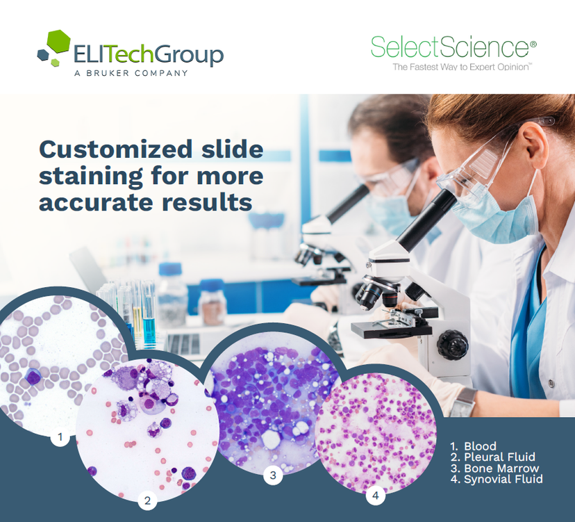 Preview - customized slide staining for more accurate results